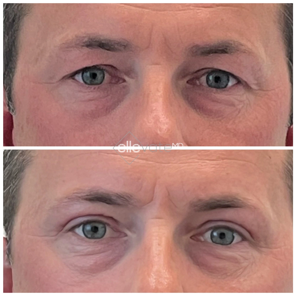 created by photogrid