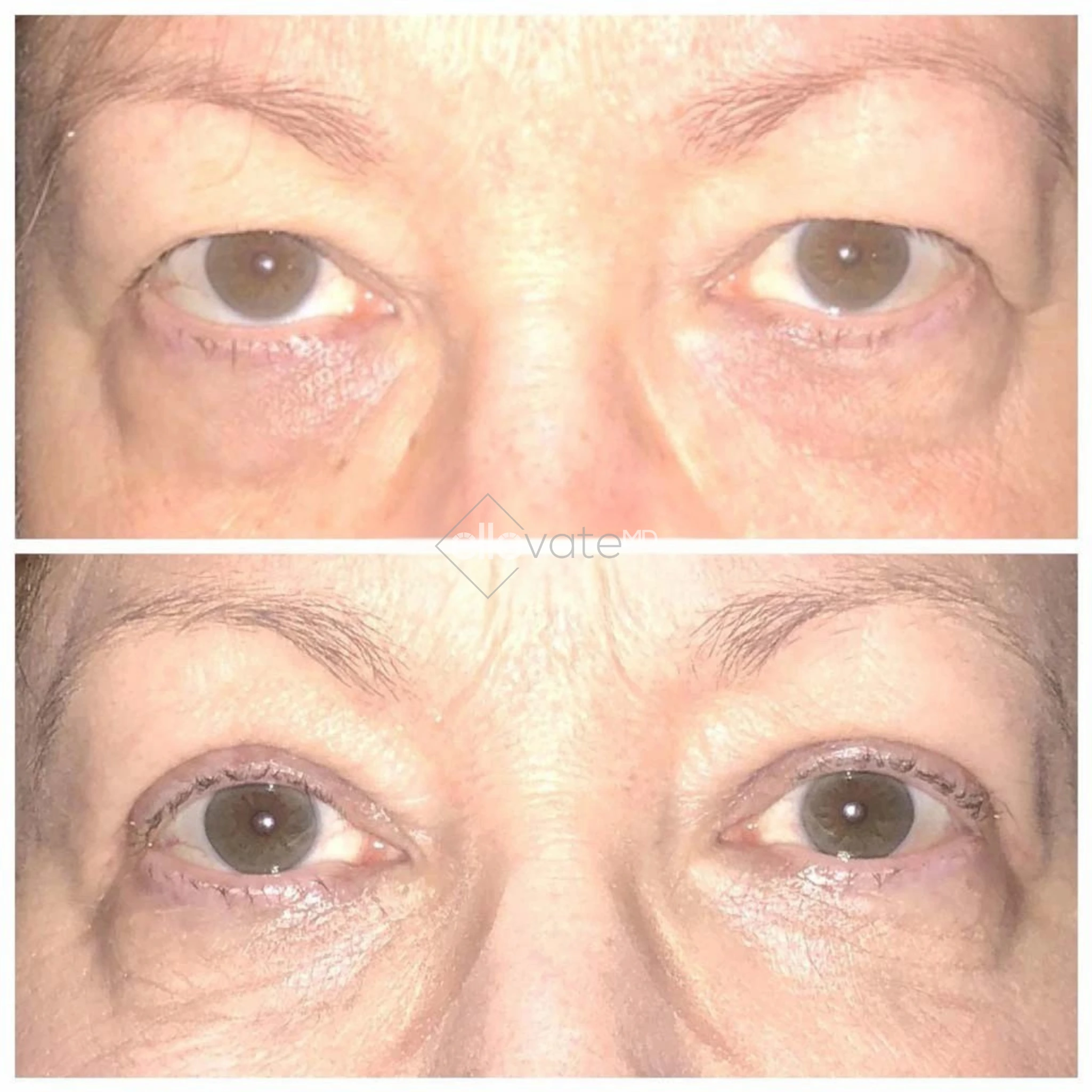 ellevate - 2025-03-22T161705.022