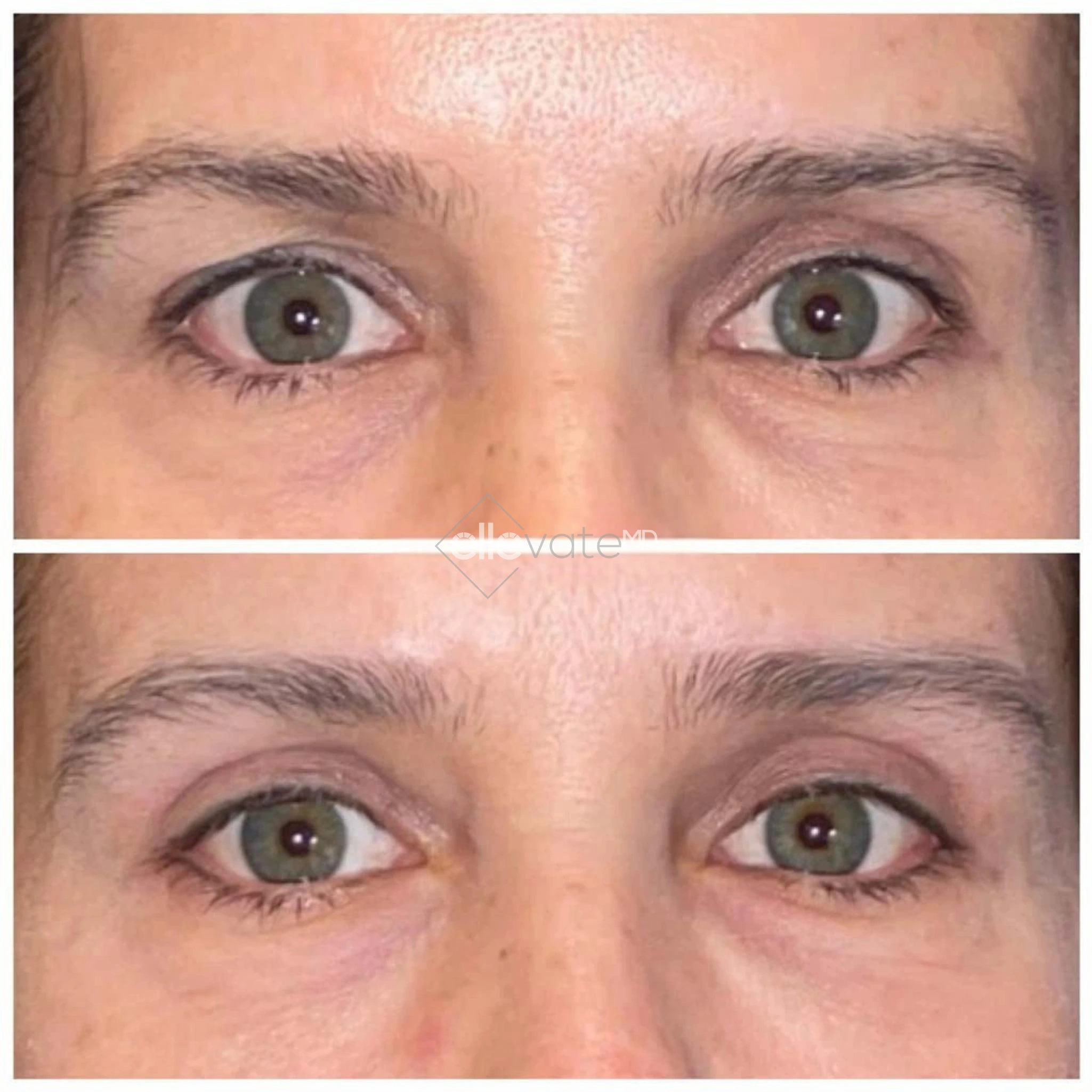 ellevate - 2025-03-22T175202.981