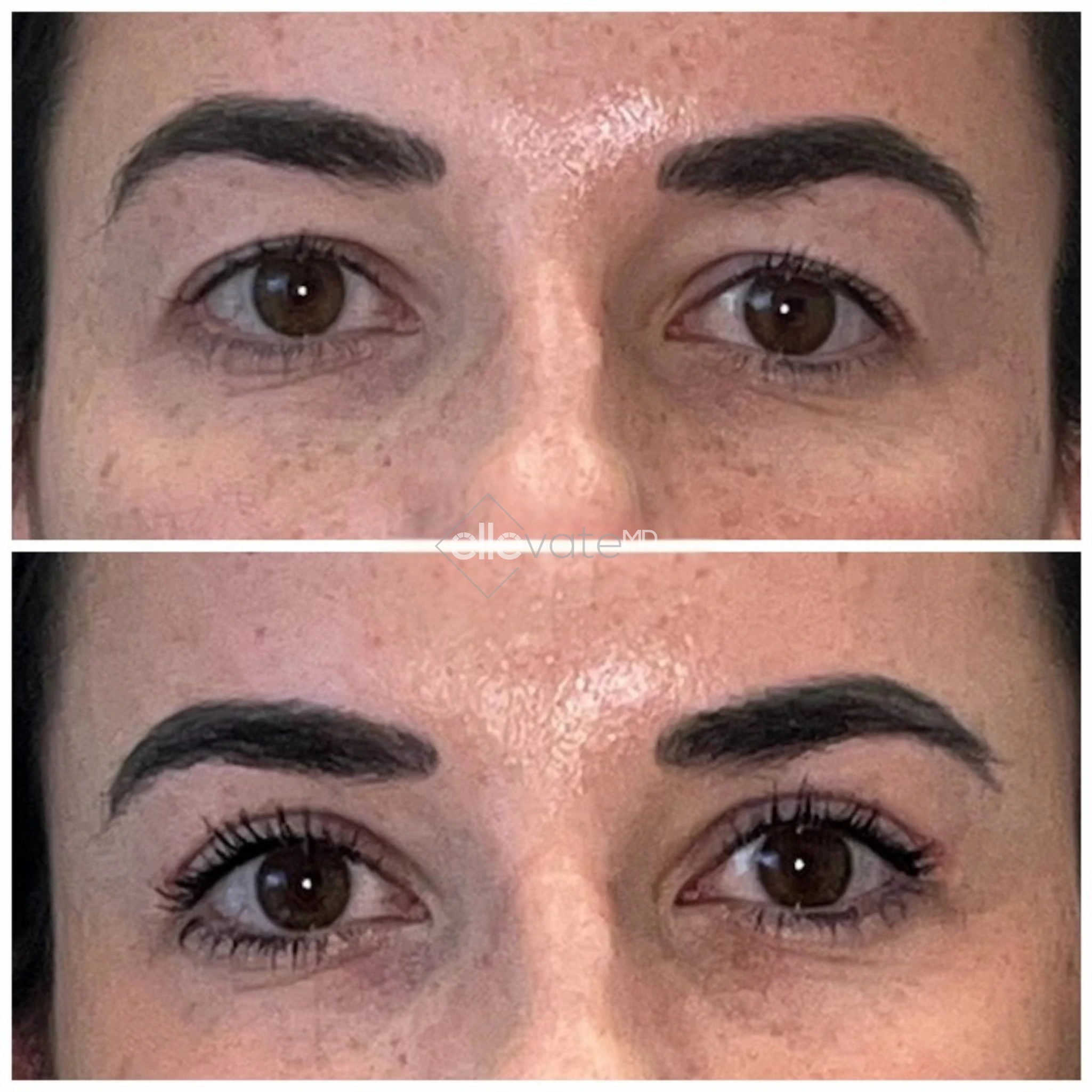 ellevate - 2025-03-22T185132.676