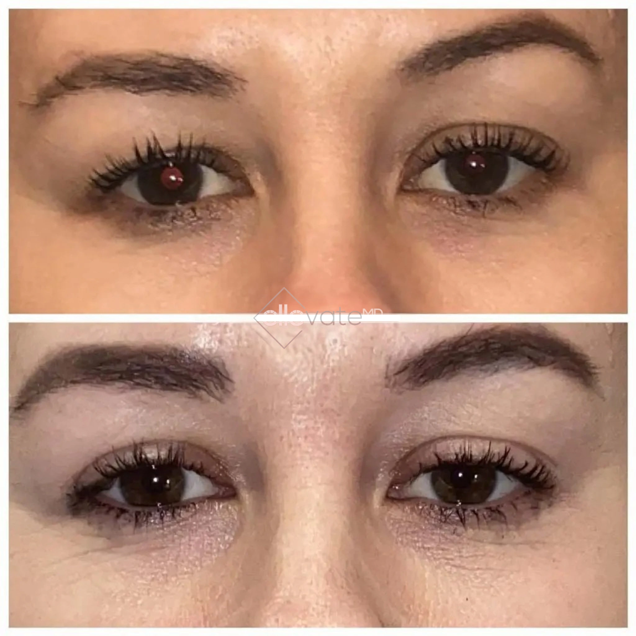 ellevate - 2025-03-22T194436.500