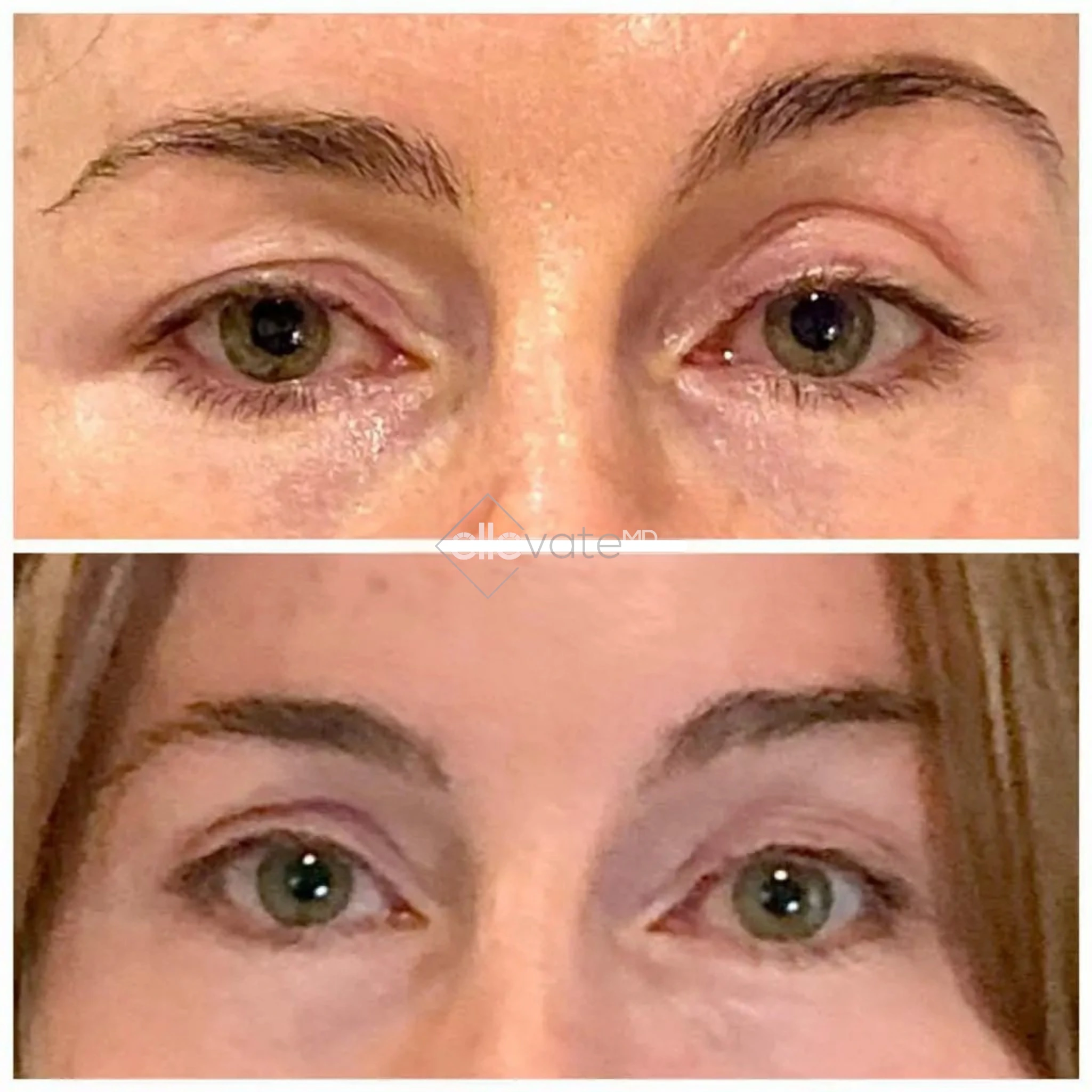 ellevate - 2025-03-22T194712.424