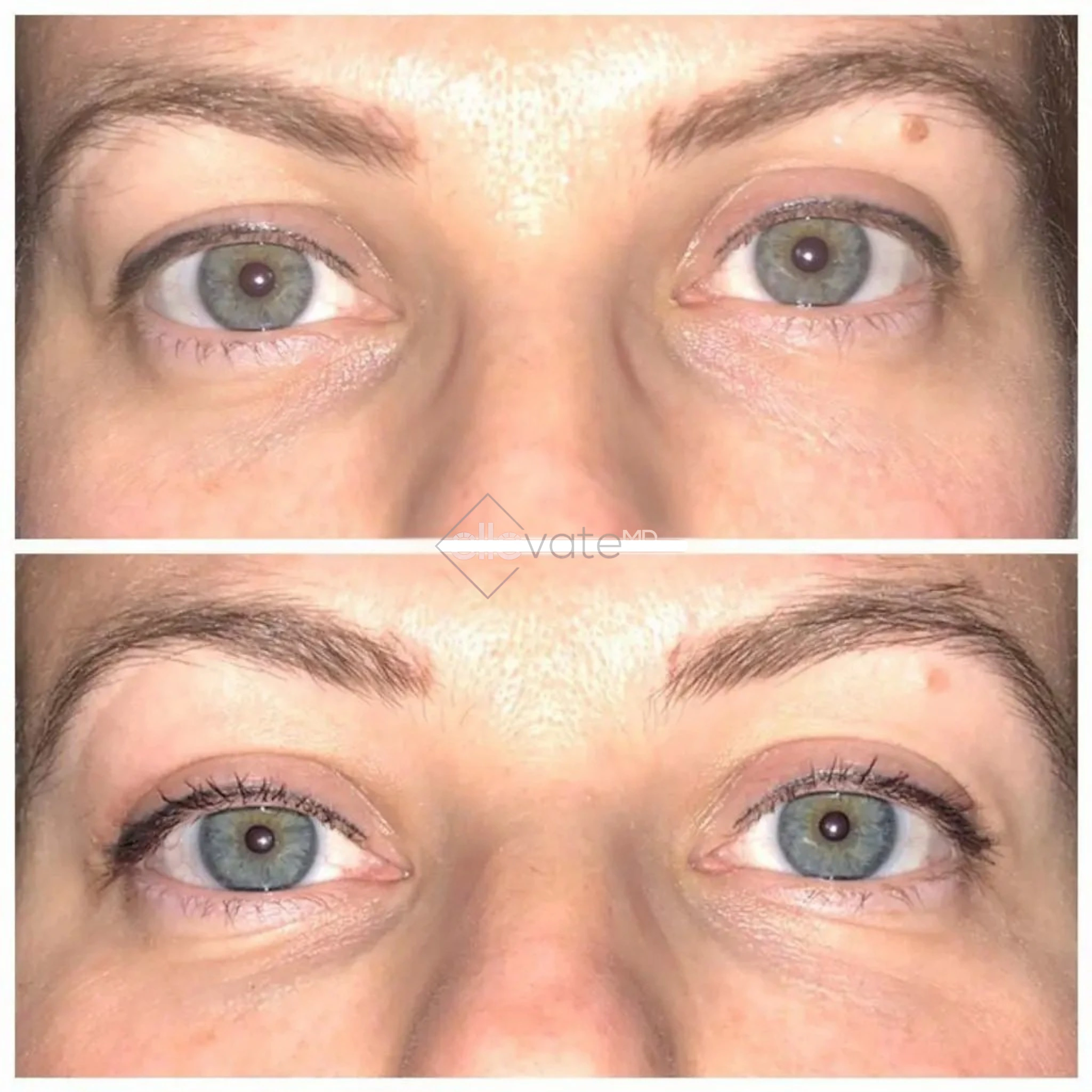 ellevate - 2025-03-22T195446.563