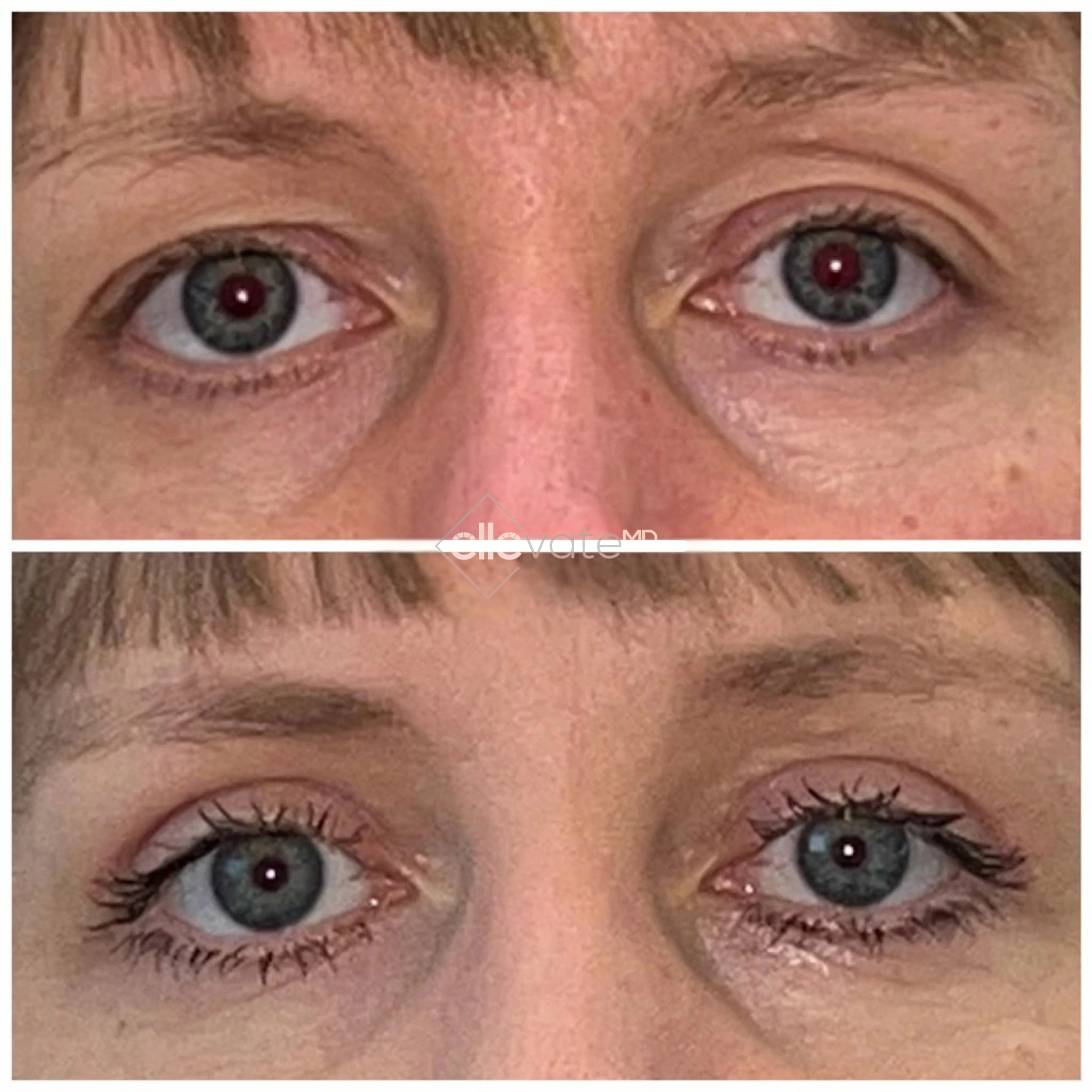 ellevate - 2025-03-22T195657.483