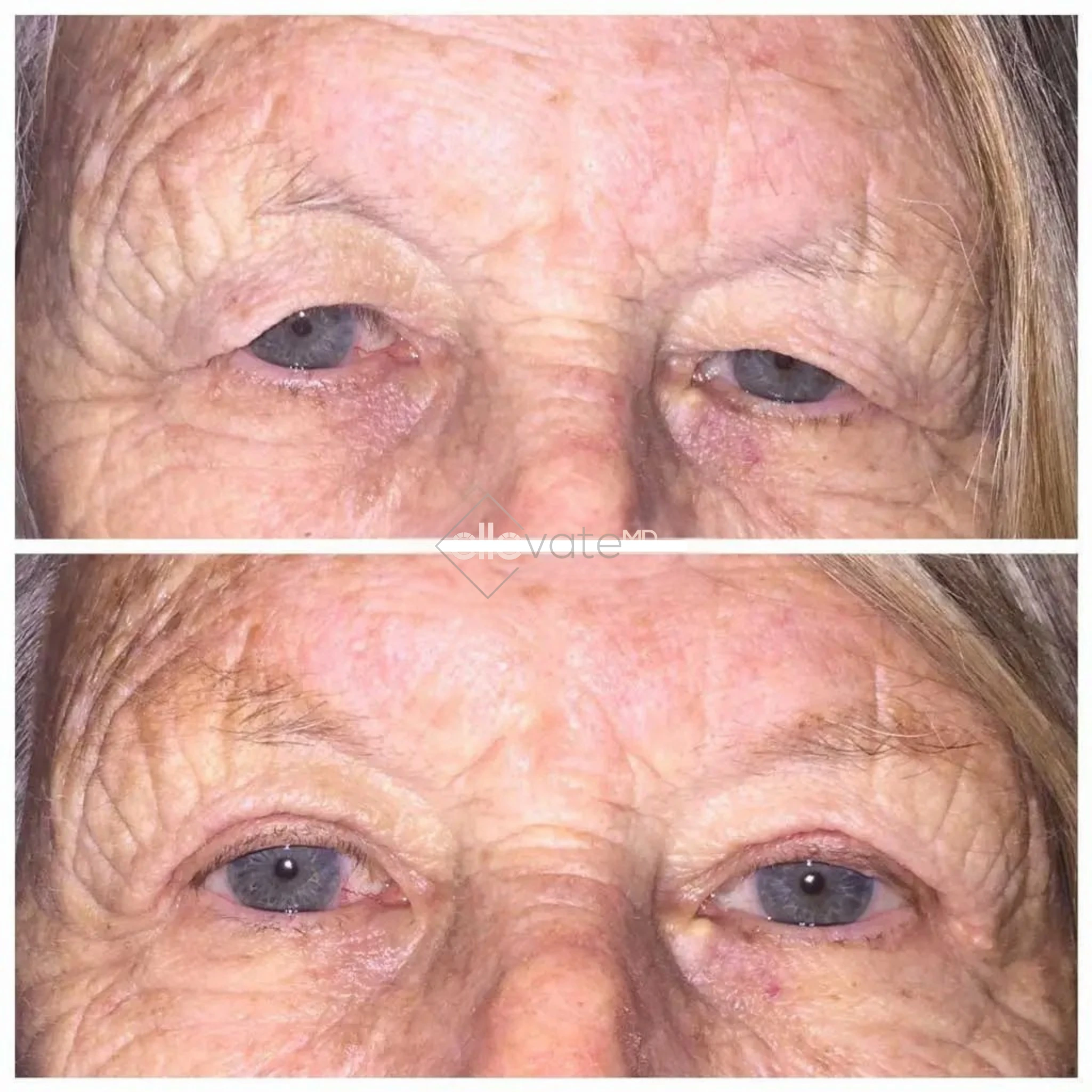 ellevate - 2025-03-22T204435.103