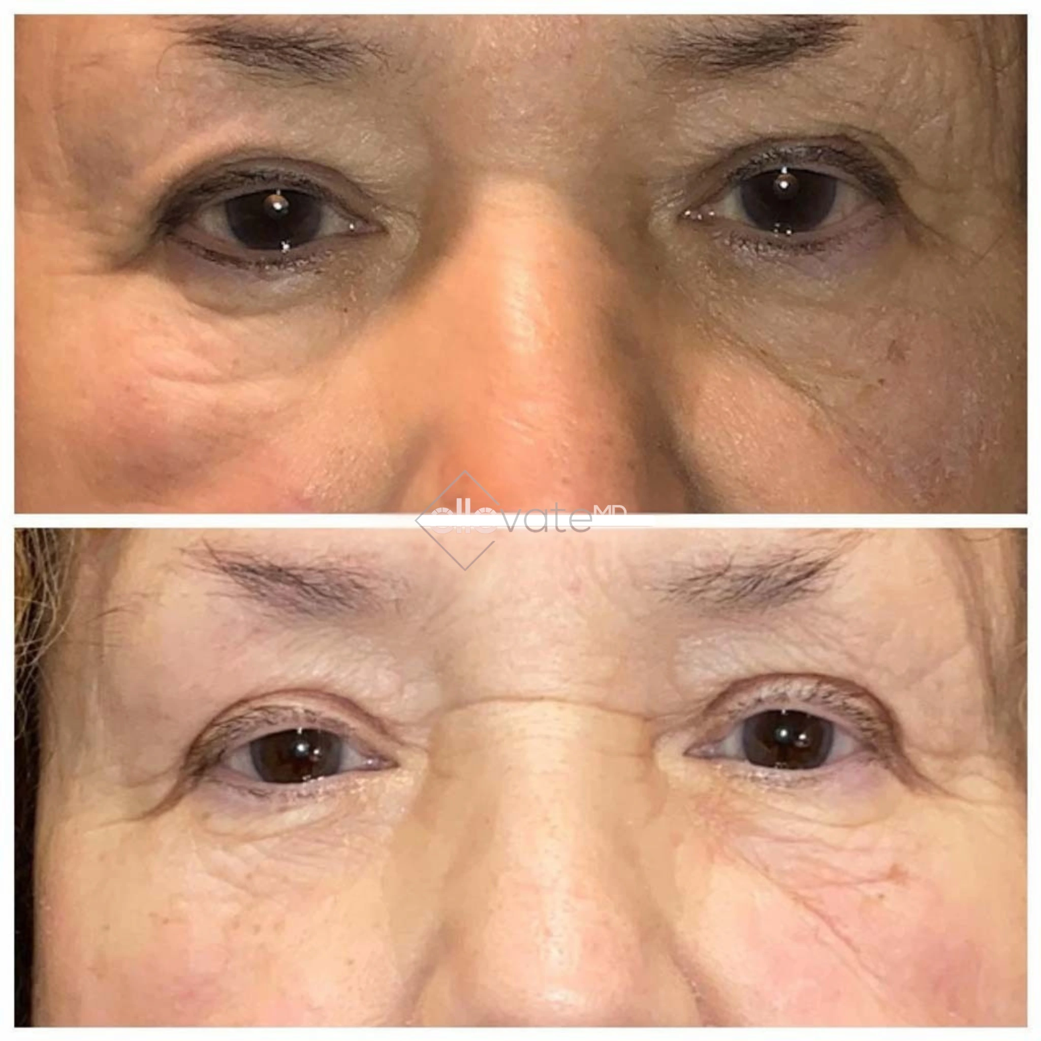 ellevate - 2025-03-22T204751.896