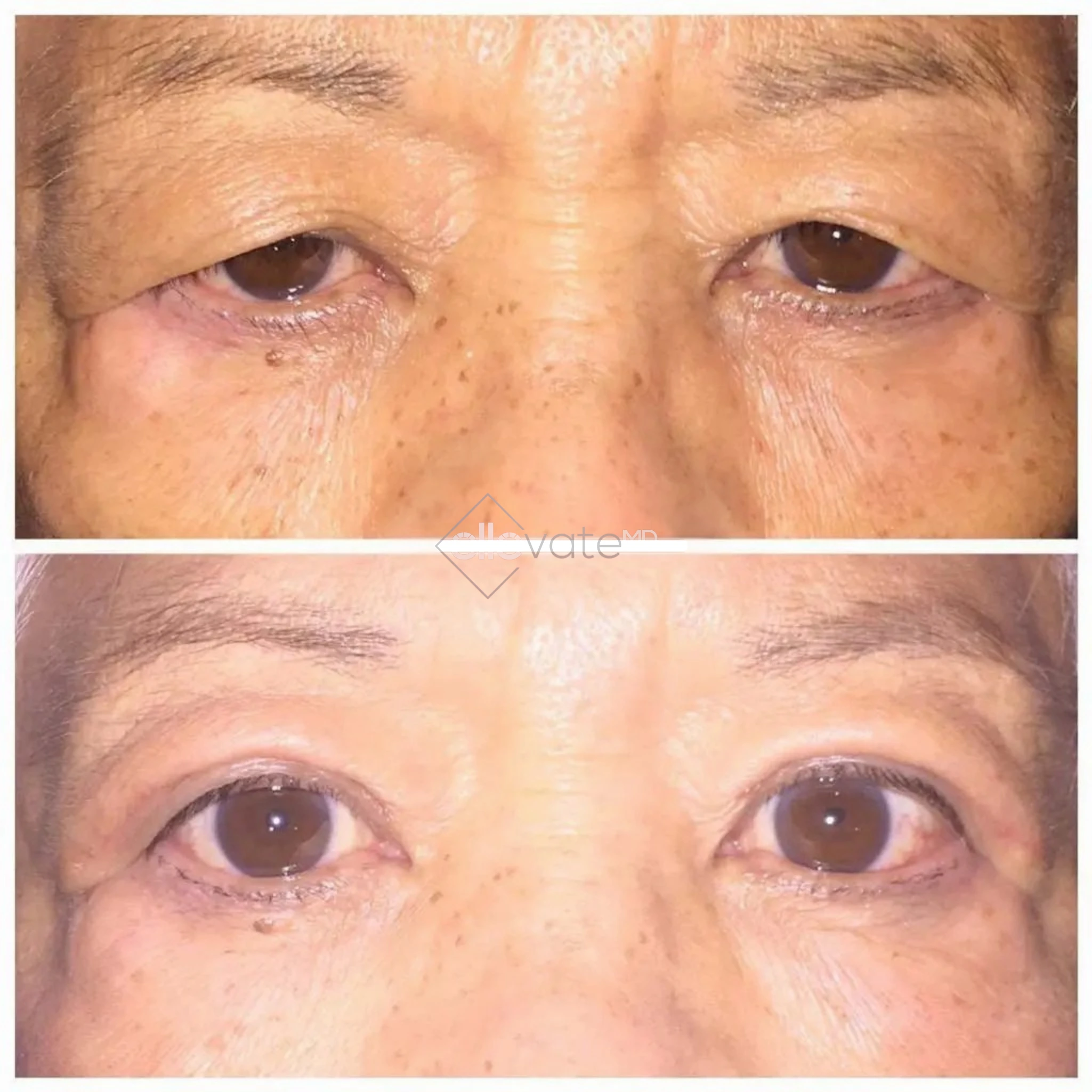 ellevate - 2025-03-22T213130.722