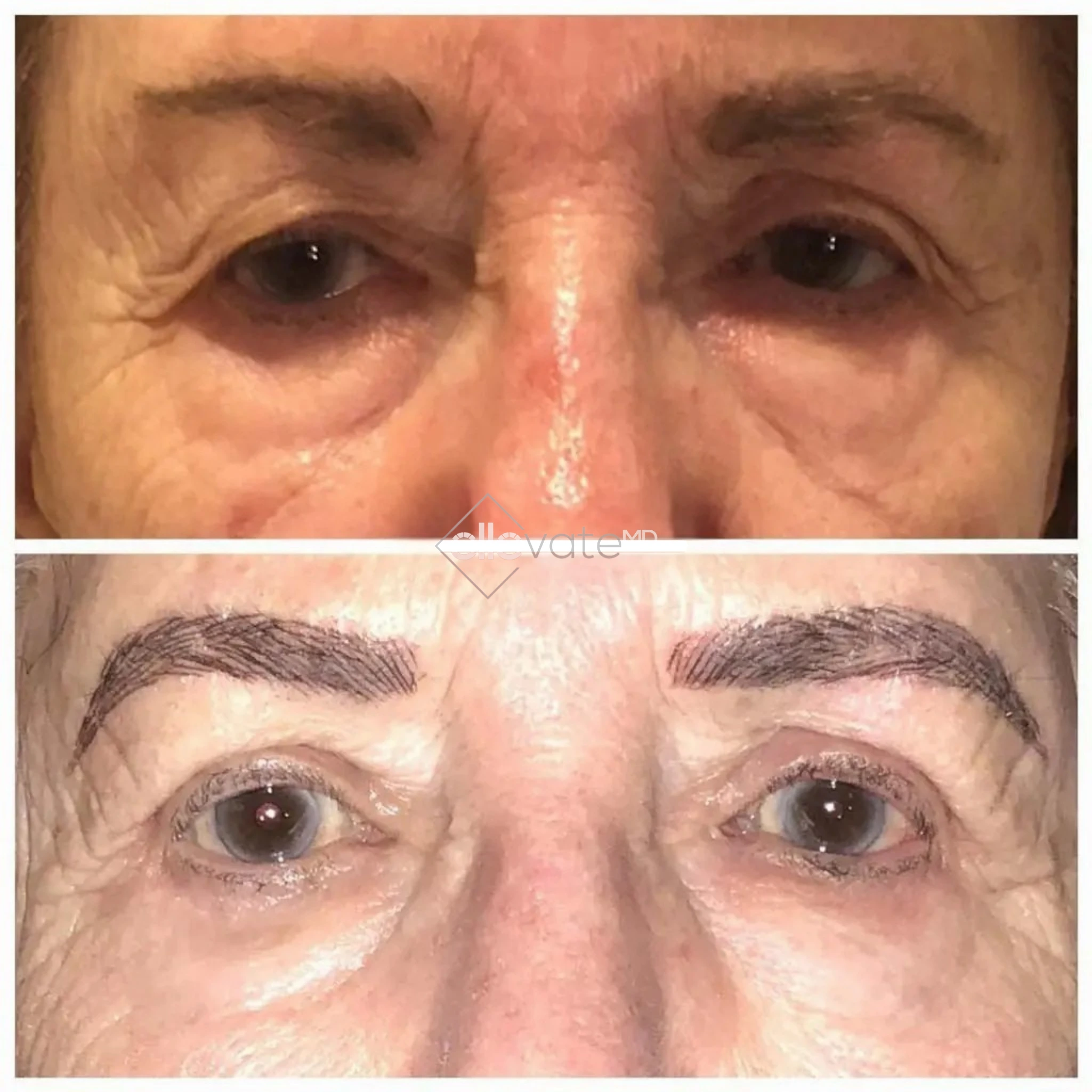 ellevate - 2025-03-22T213337.337