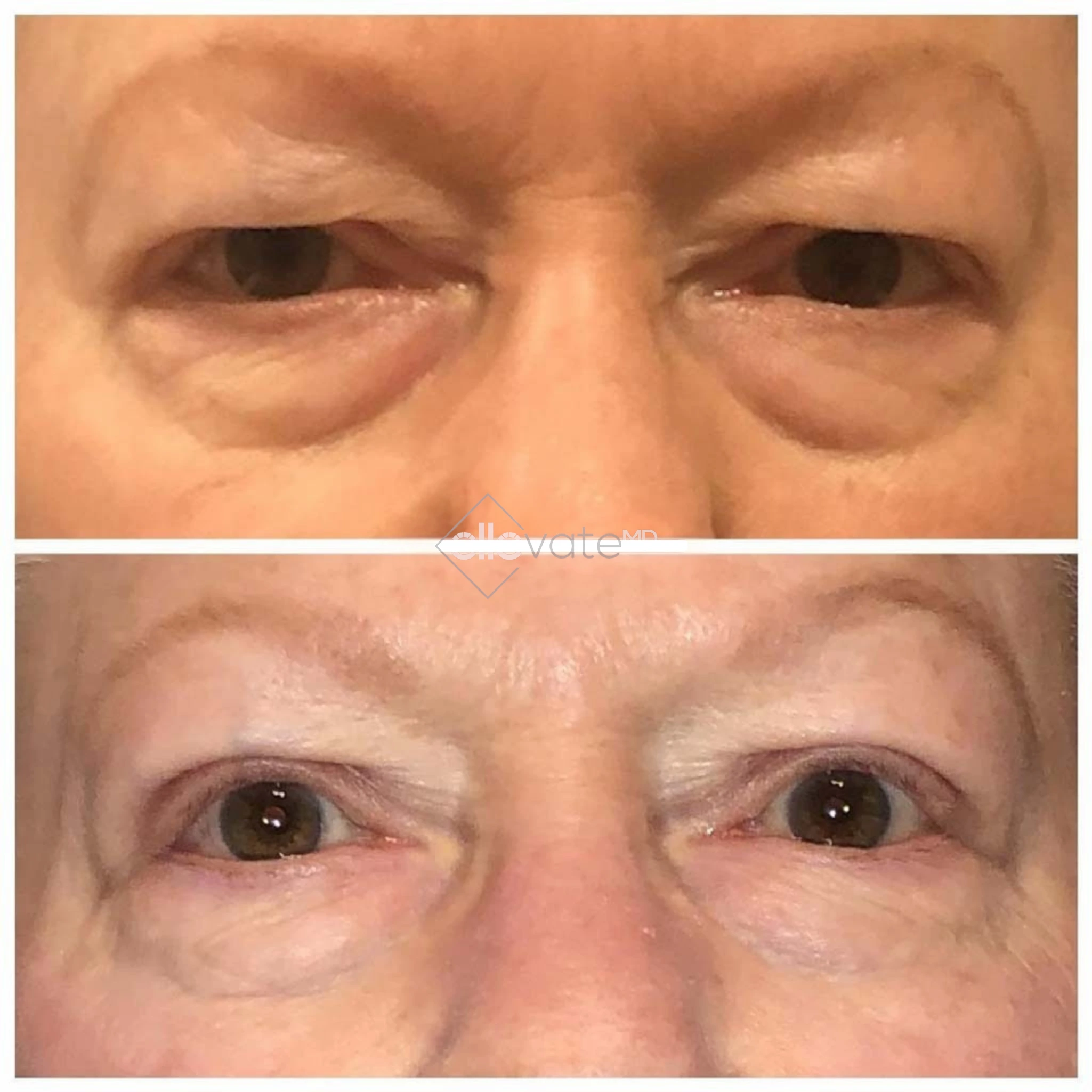 ellevate - 2025-03-22T213521.562