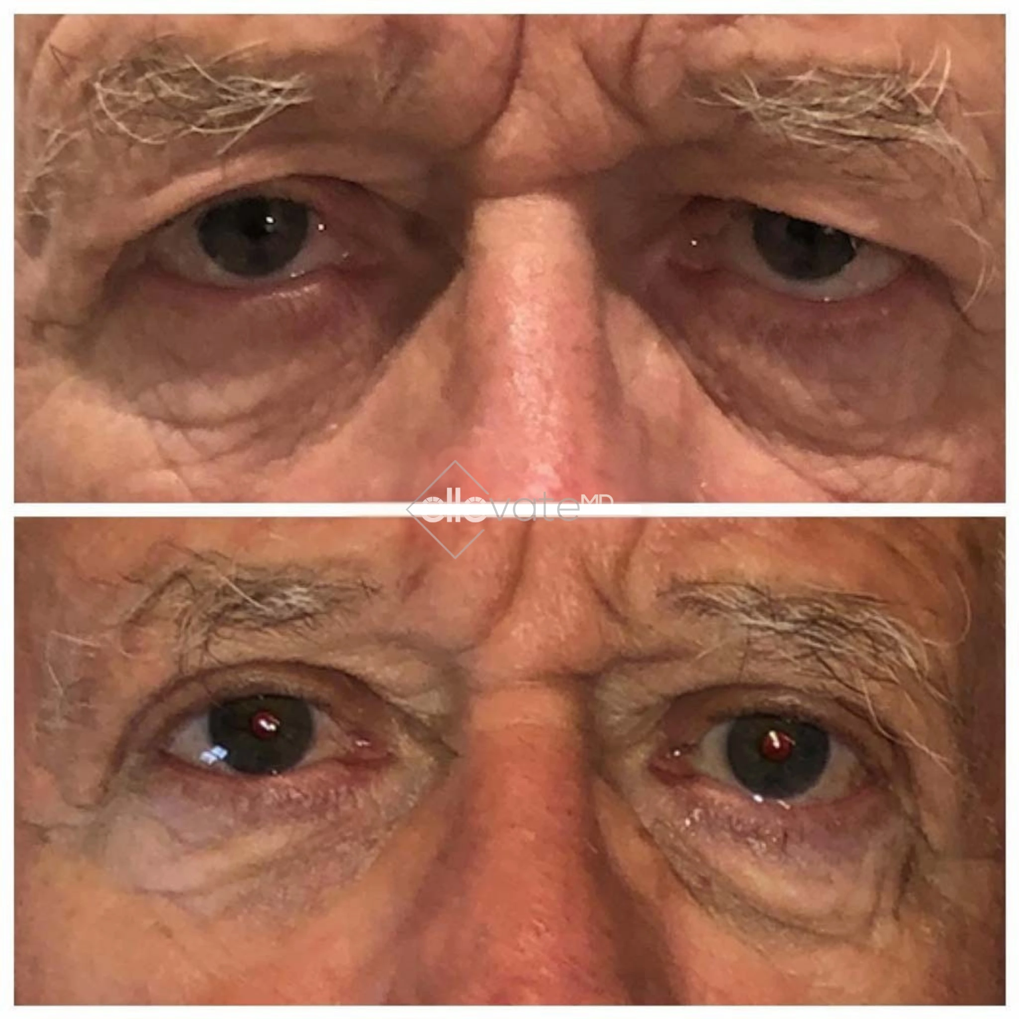 ellevate - 2025-03-22T214840.626