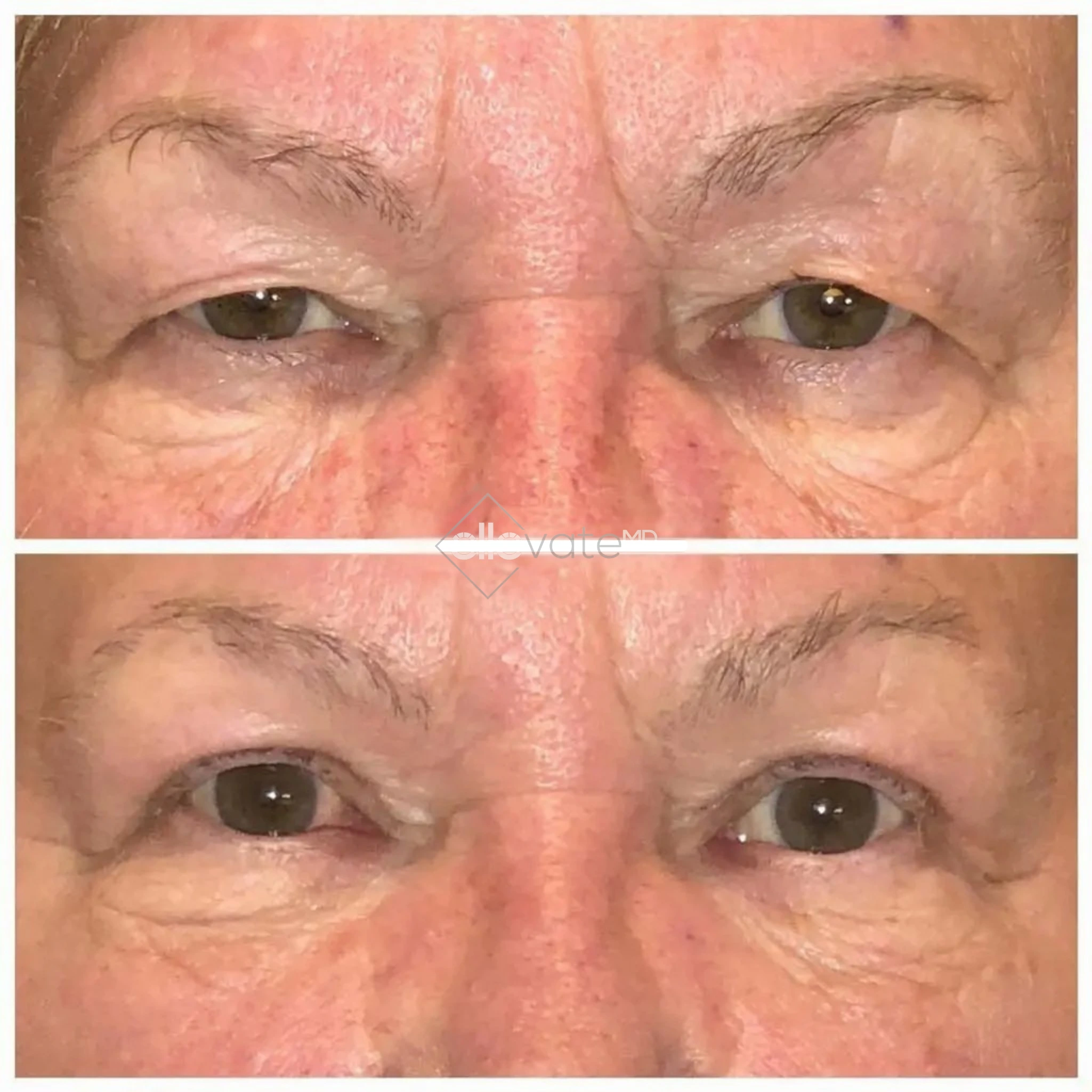 ellevate - 2025-03-22T215225.687