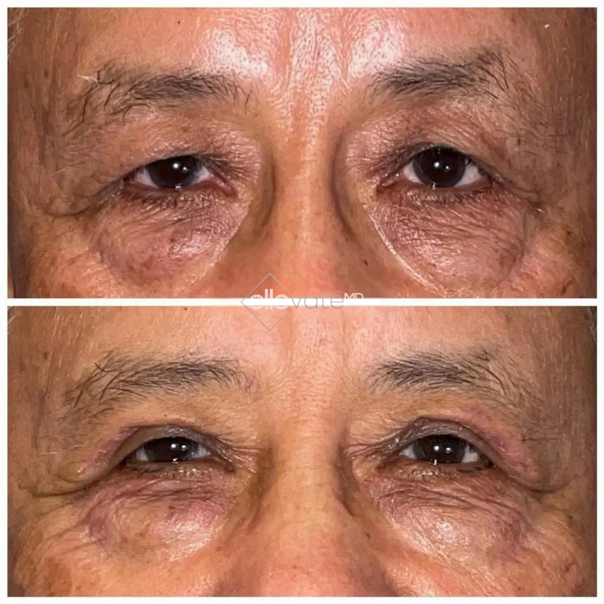 ellevate - 2025-03-22T215426.225