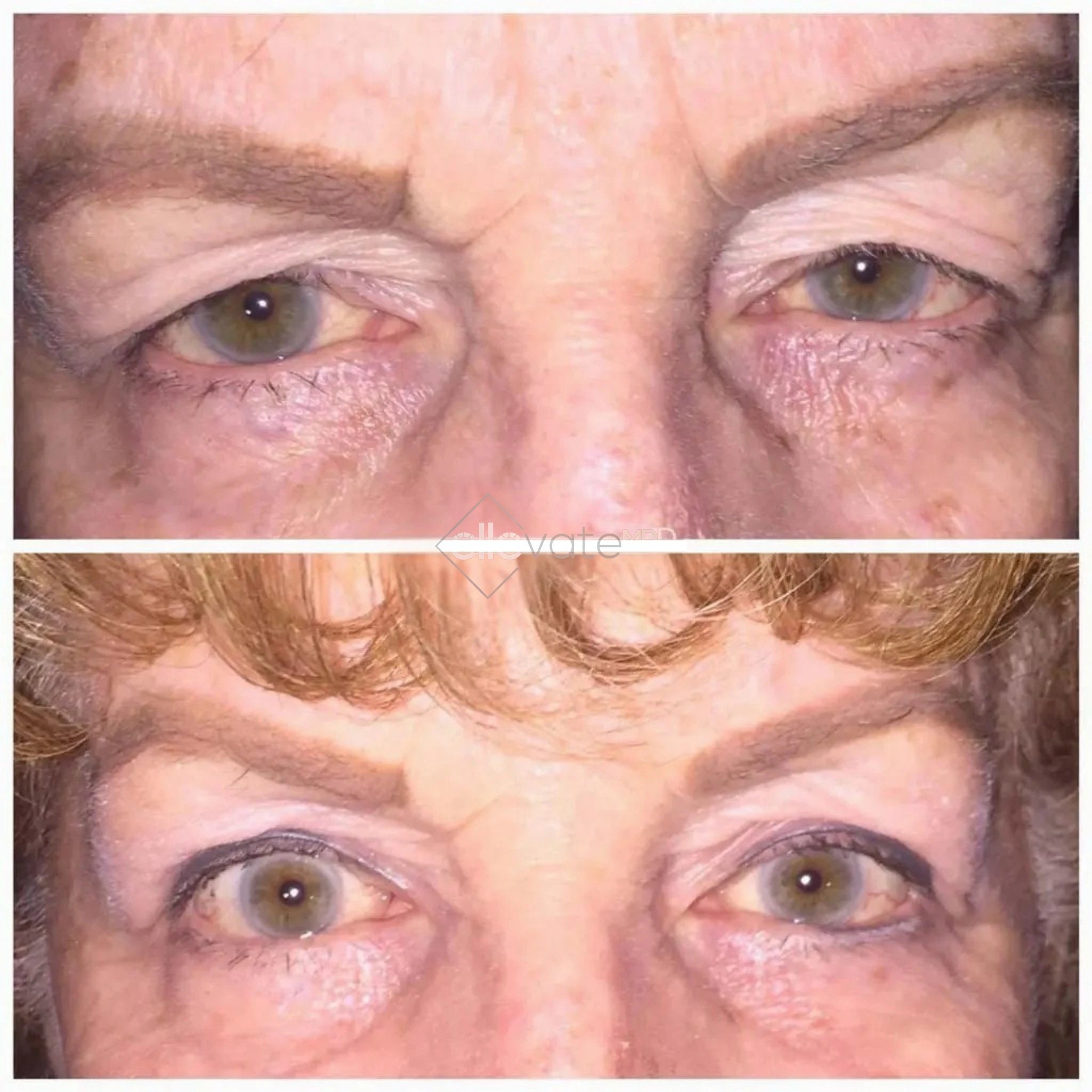 ellevate - 2025-03-22T215714.655