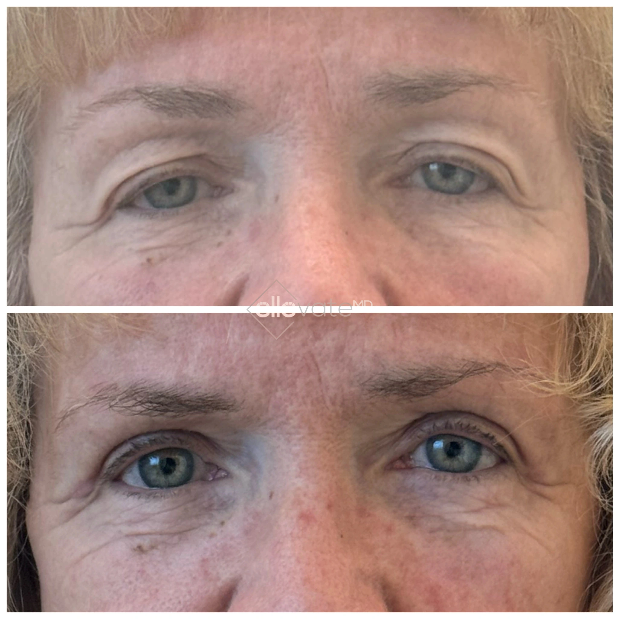 ellevate - 2025-03-22T215900.368