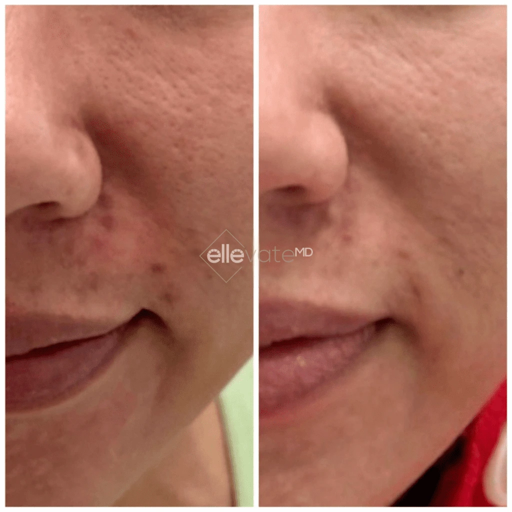 ellevate - 2025-03-23T110714.198