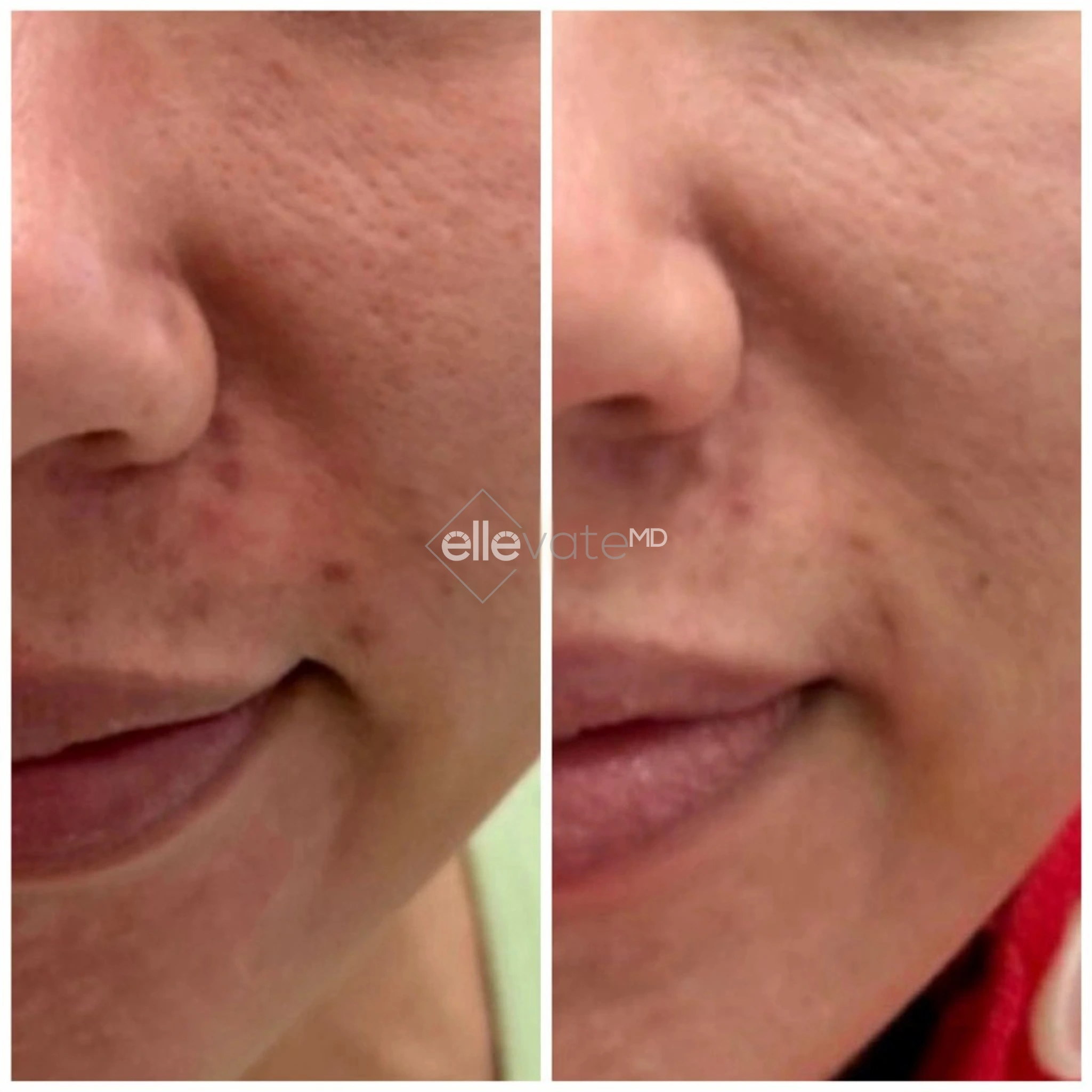 ellevate - 2025-03-23T110714.198