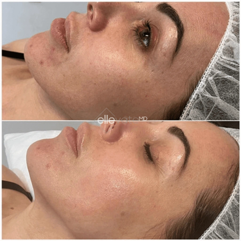 ellevate - 2025-03-23T111246.579