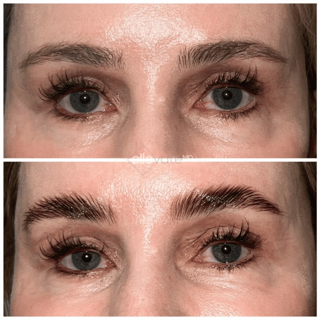 ellevate - 2025-03-23T112433.475