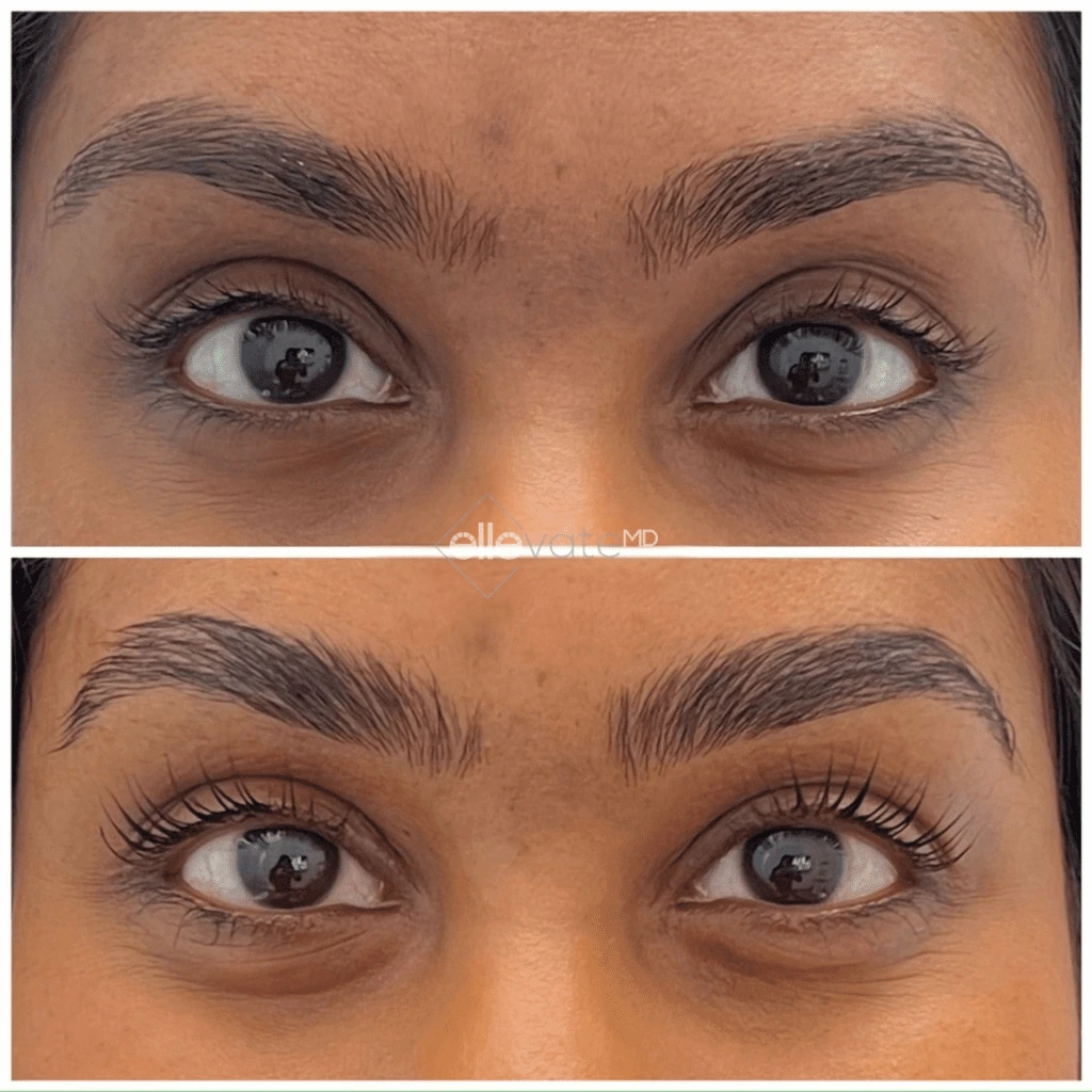 ellevate - 2025-03-23T113017.408