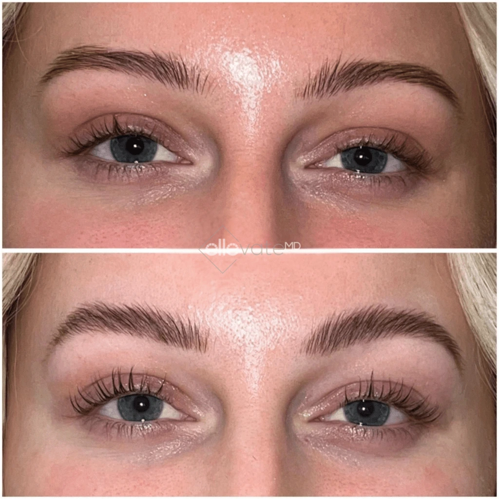 ellevate - 2025-03-23T113141.192