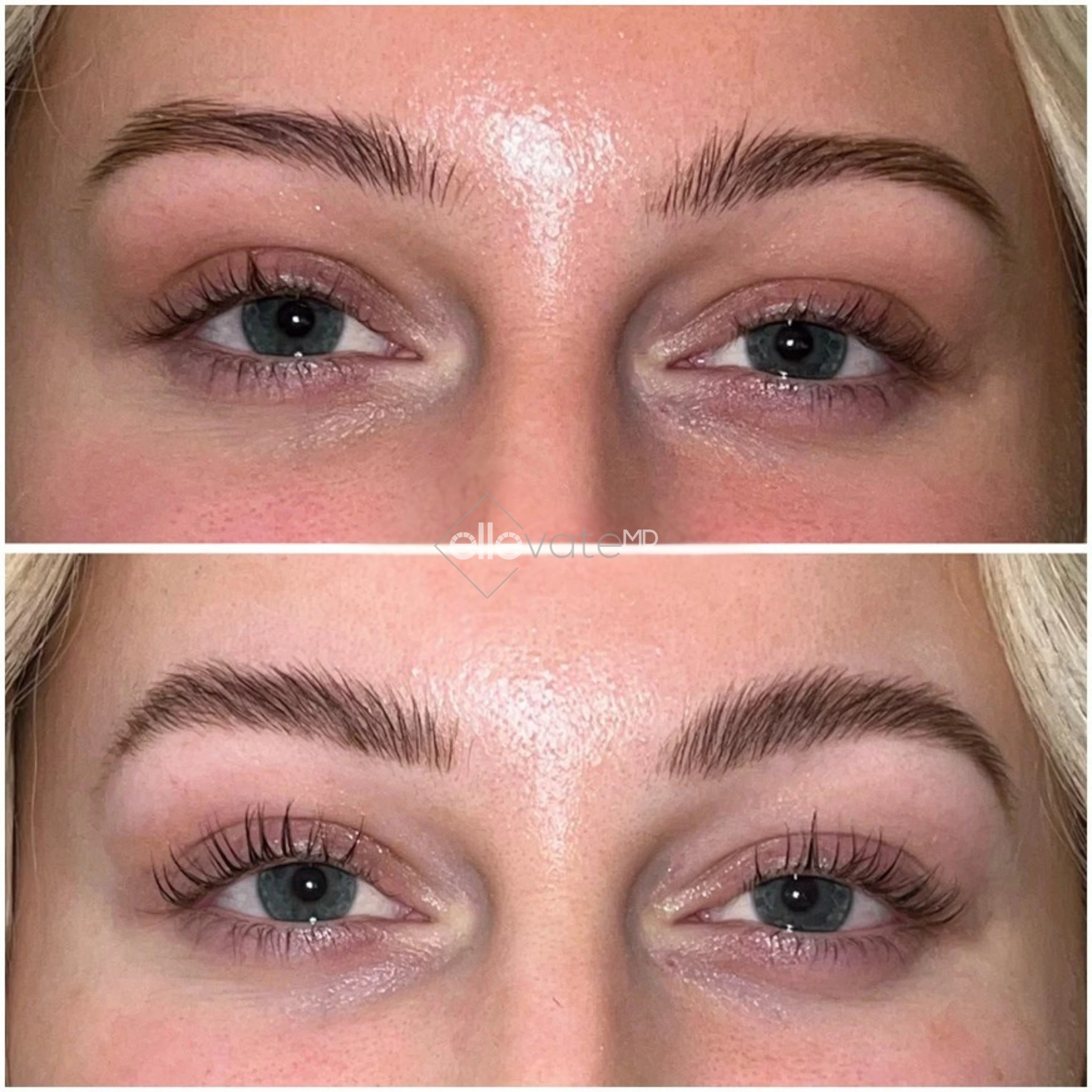 ellevate - 2025-03-23T113141.192