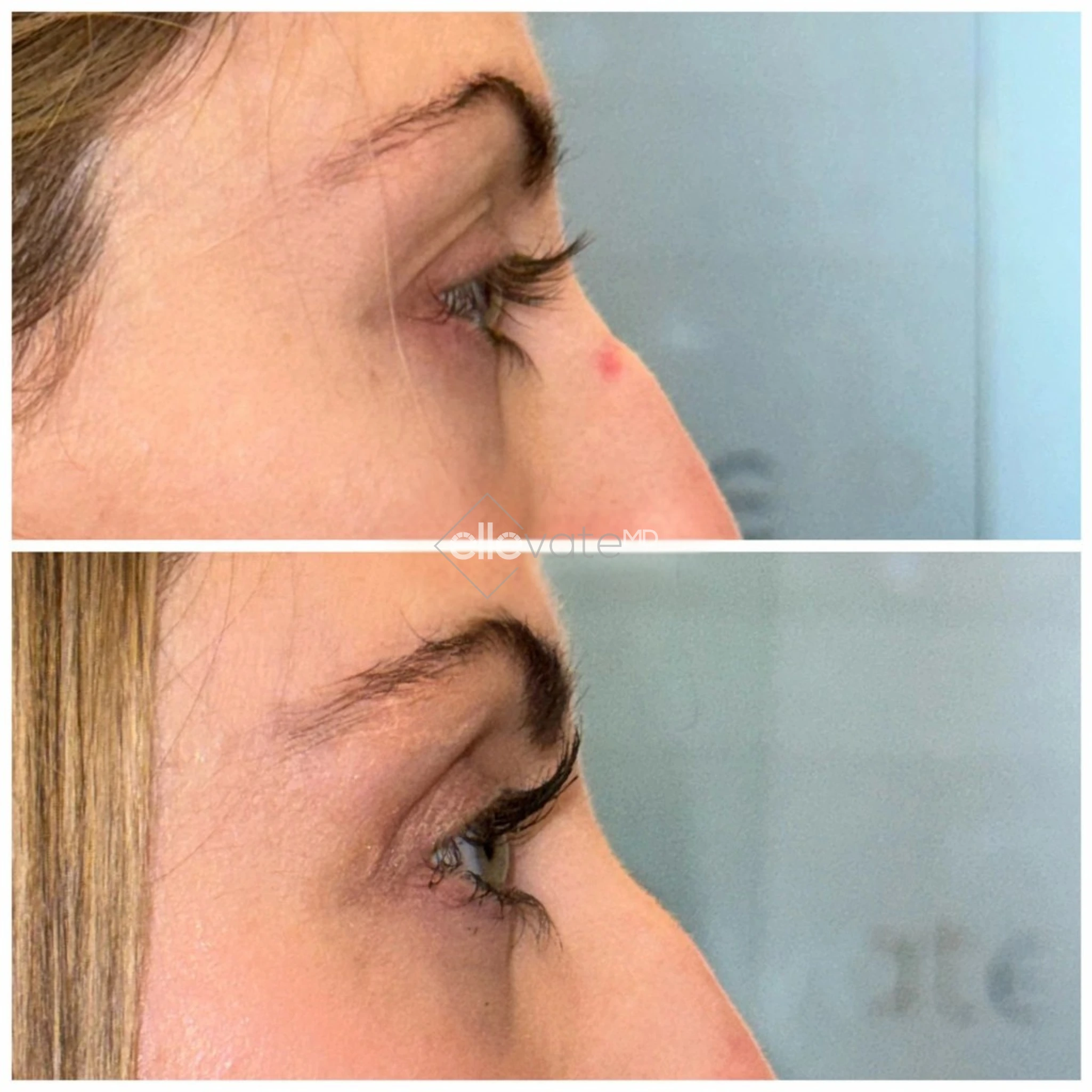 ellevate - 2025-03-23T114115.248