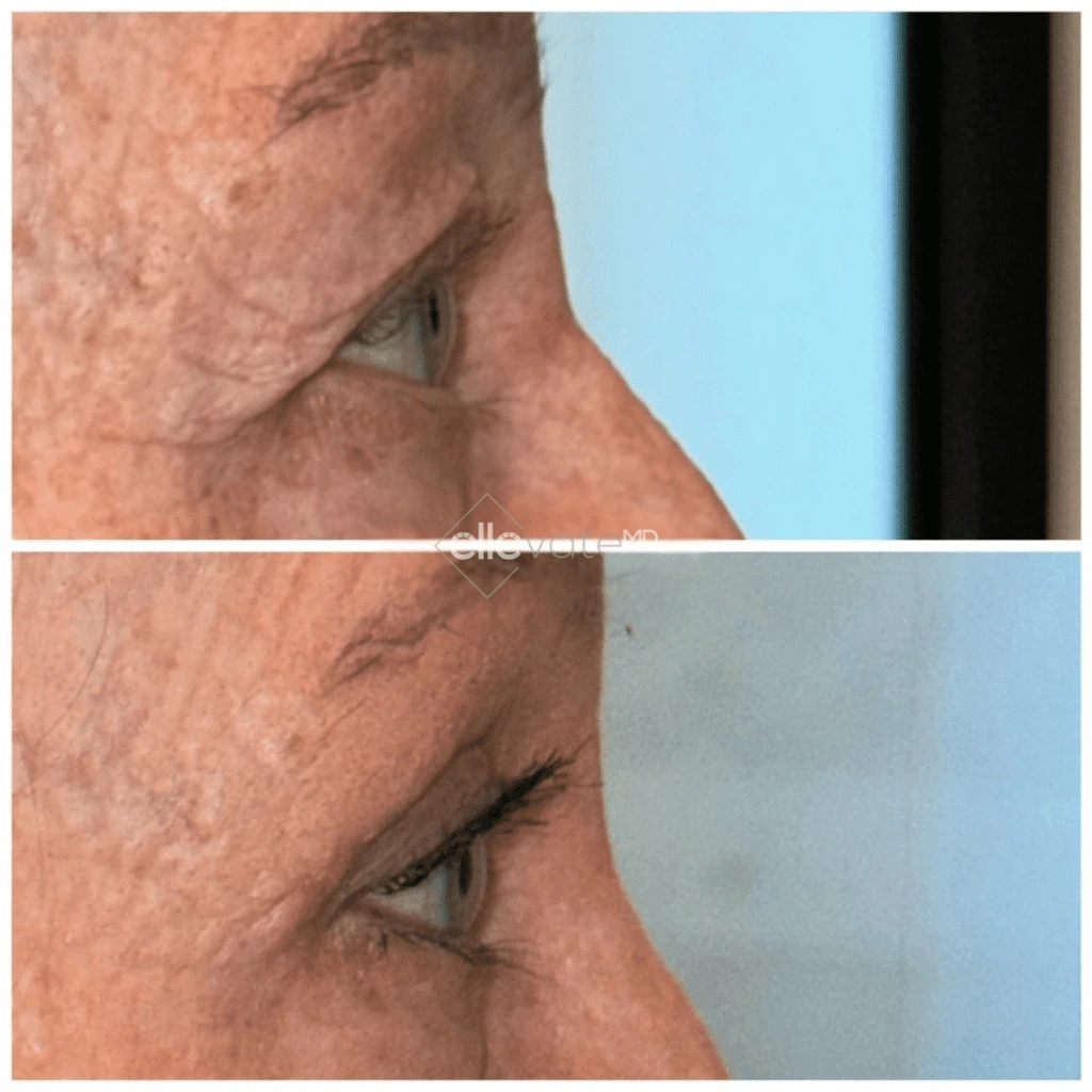 ellevate - 2025-03-23T114503.550