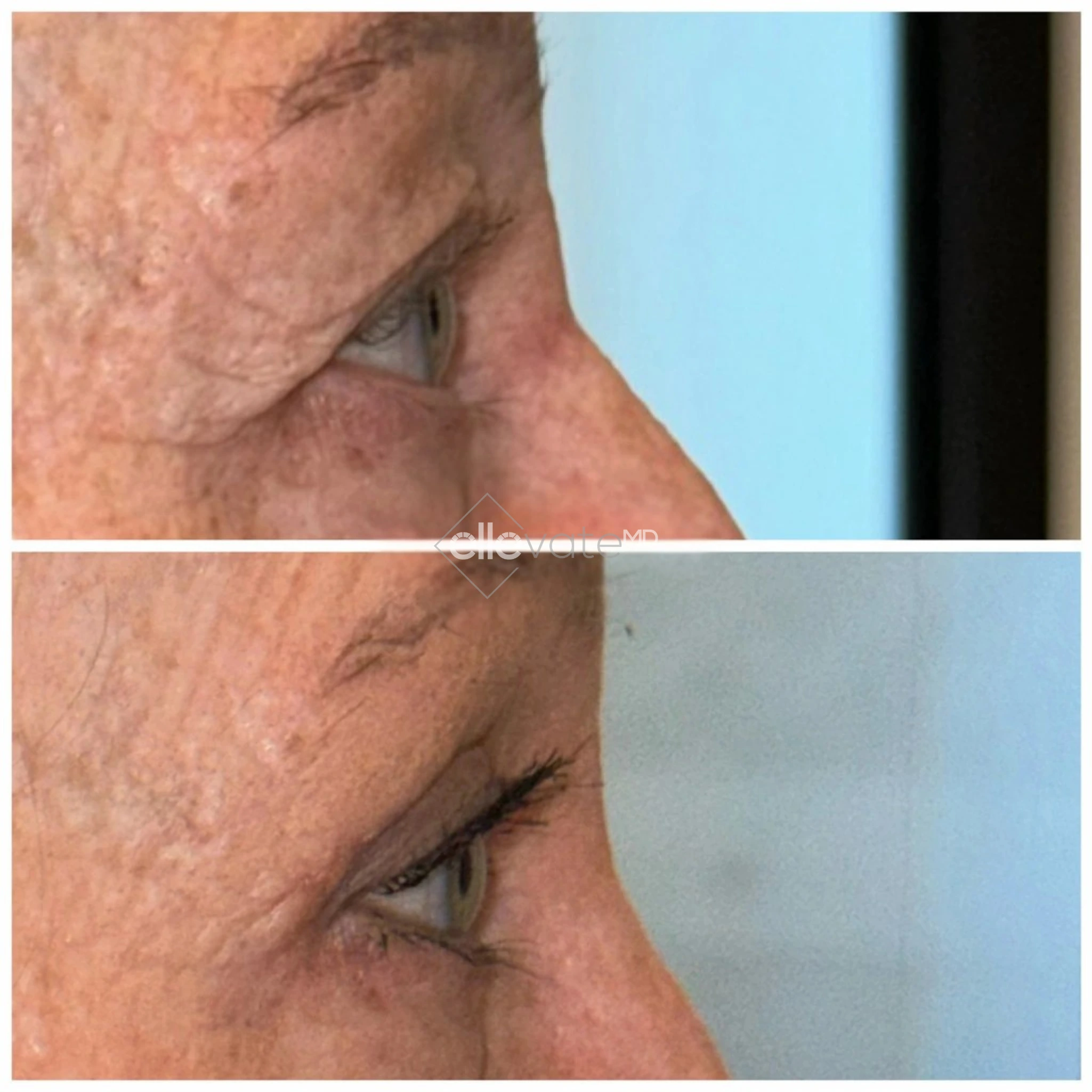 ellevate - 2025-03-23T114503.550