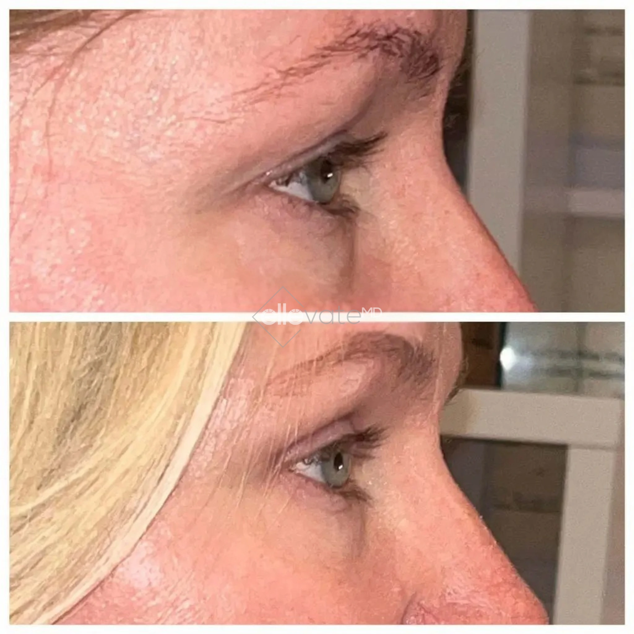 ellevate - 2025-03-23T114629.184