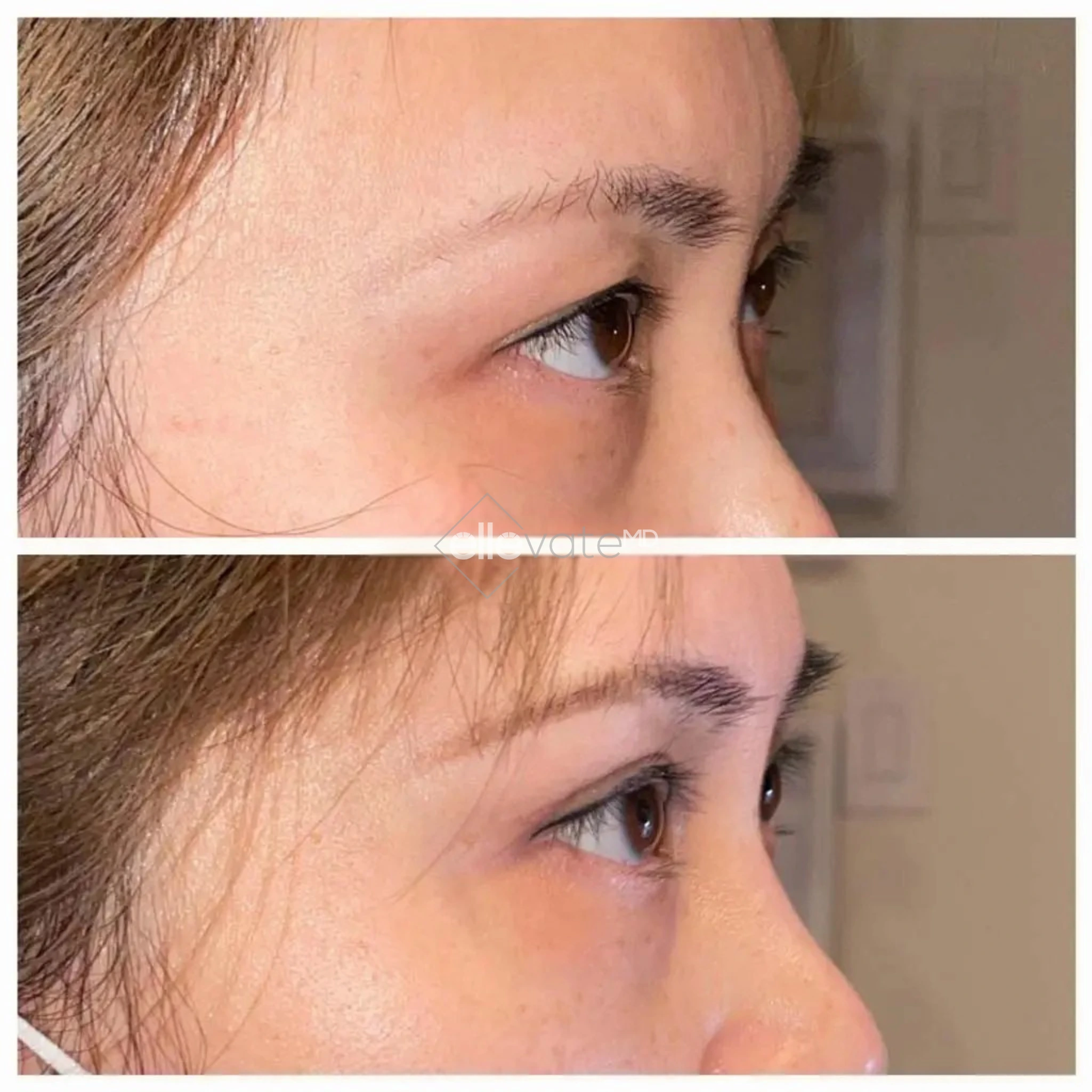 ellevate - 2025-03-23T115507.337