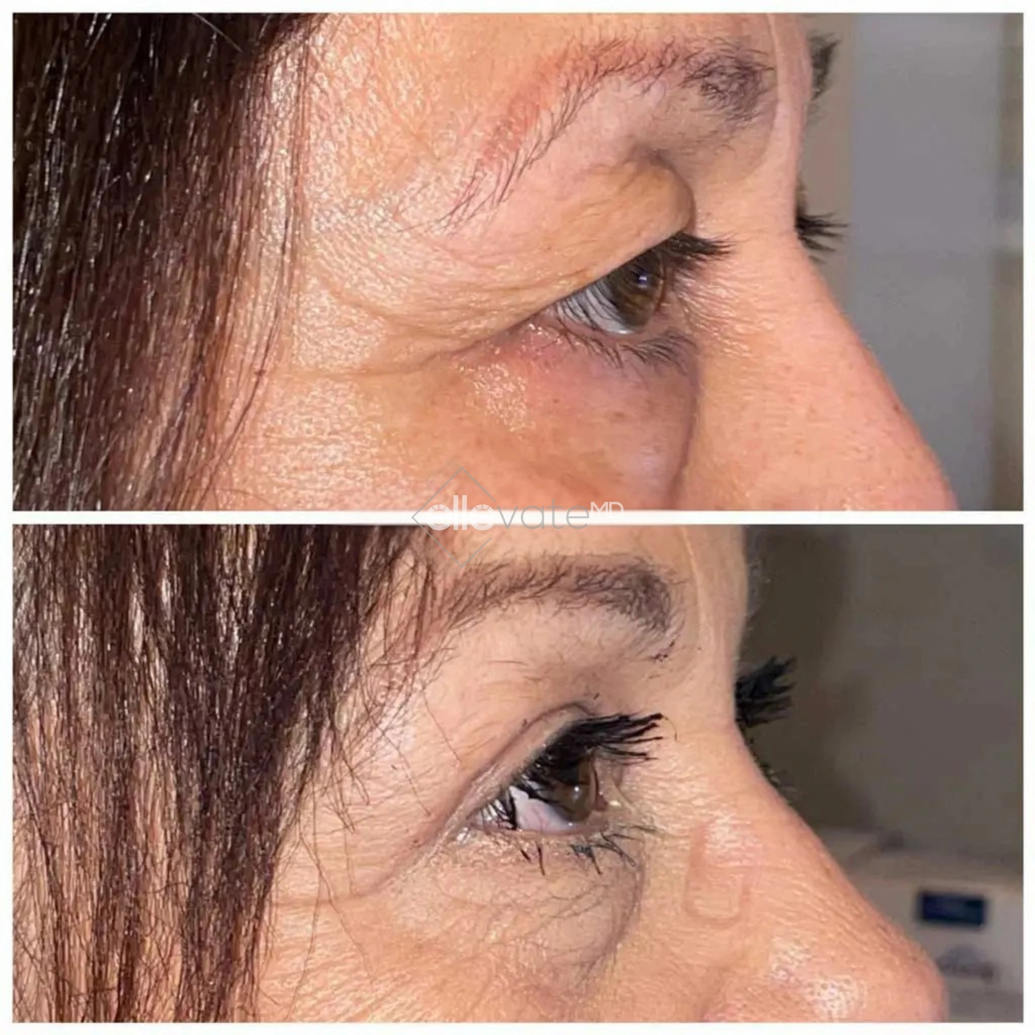 ellevate - 2025-03-23T120646.301