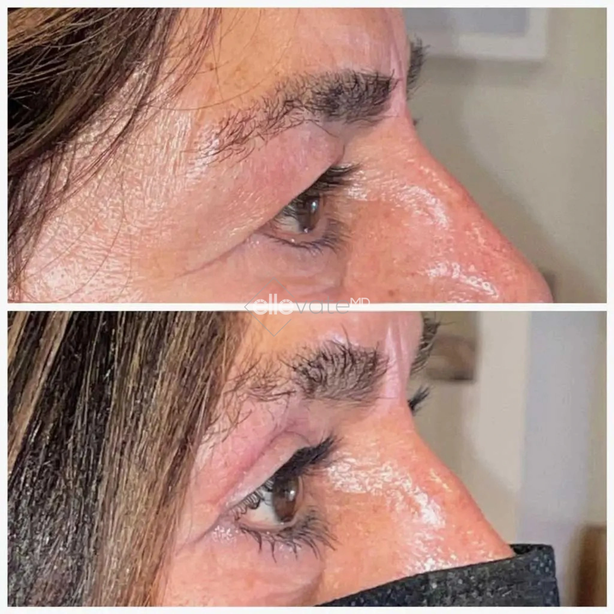 ellevate - 2025-03-23T121301.325