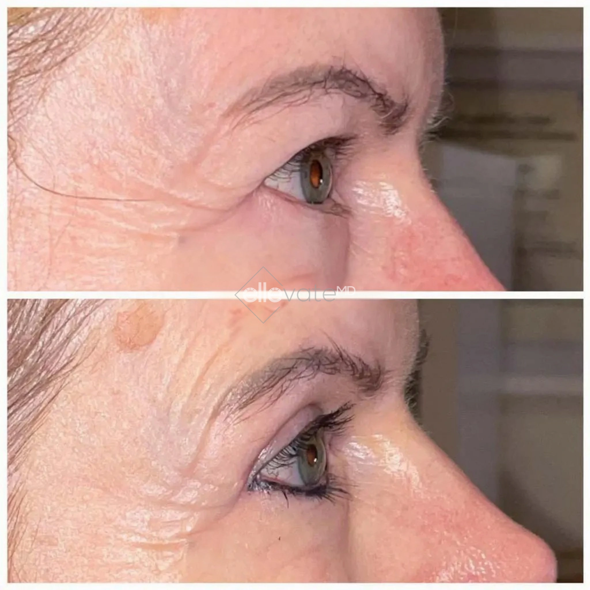 ellevate - 2025-03-23T121518.197