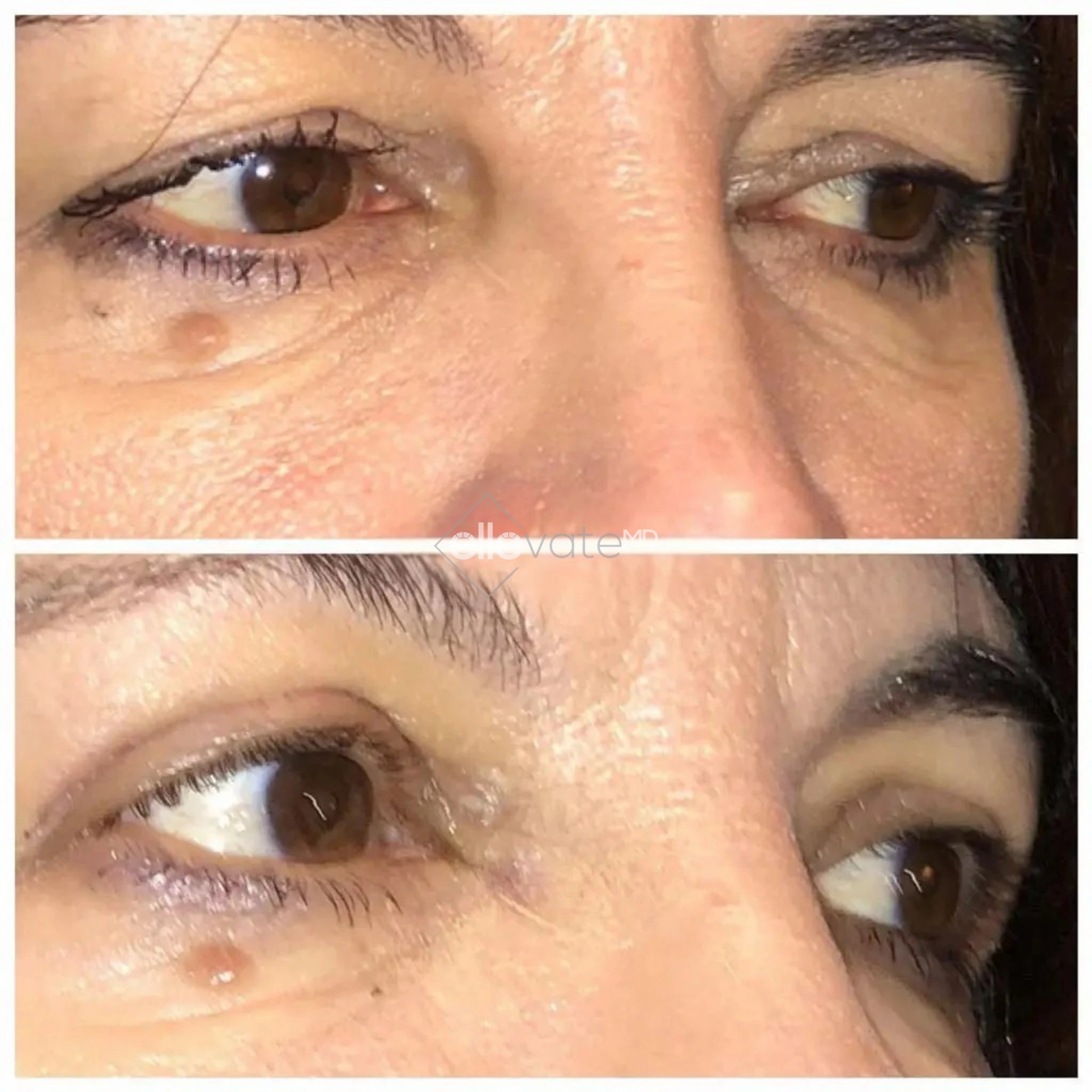 ellevate - 2025-03-23T123154.379