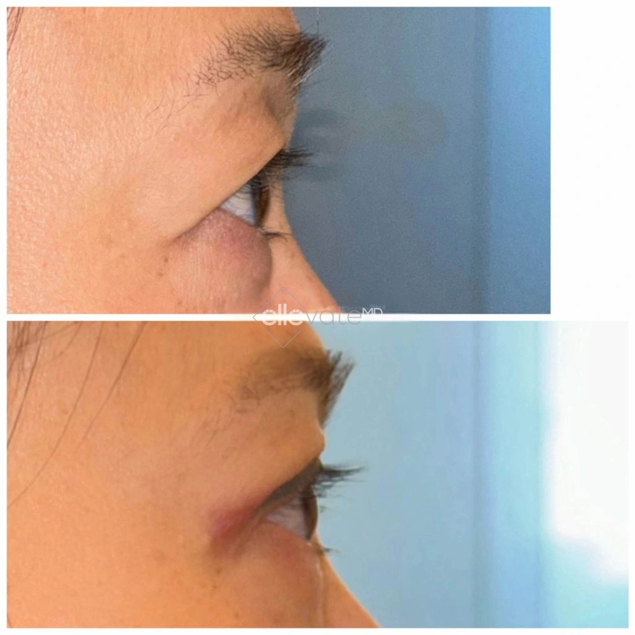 ellevate - 2025-03-23T123858.286