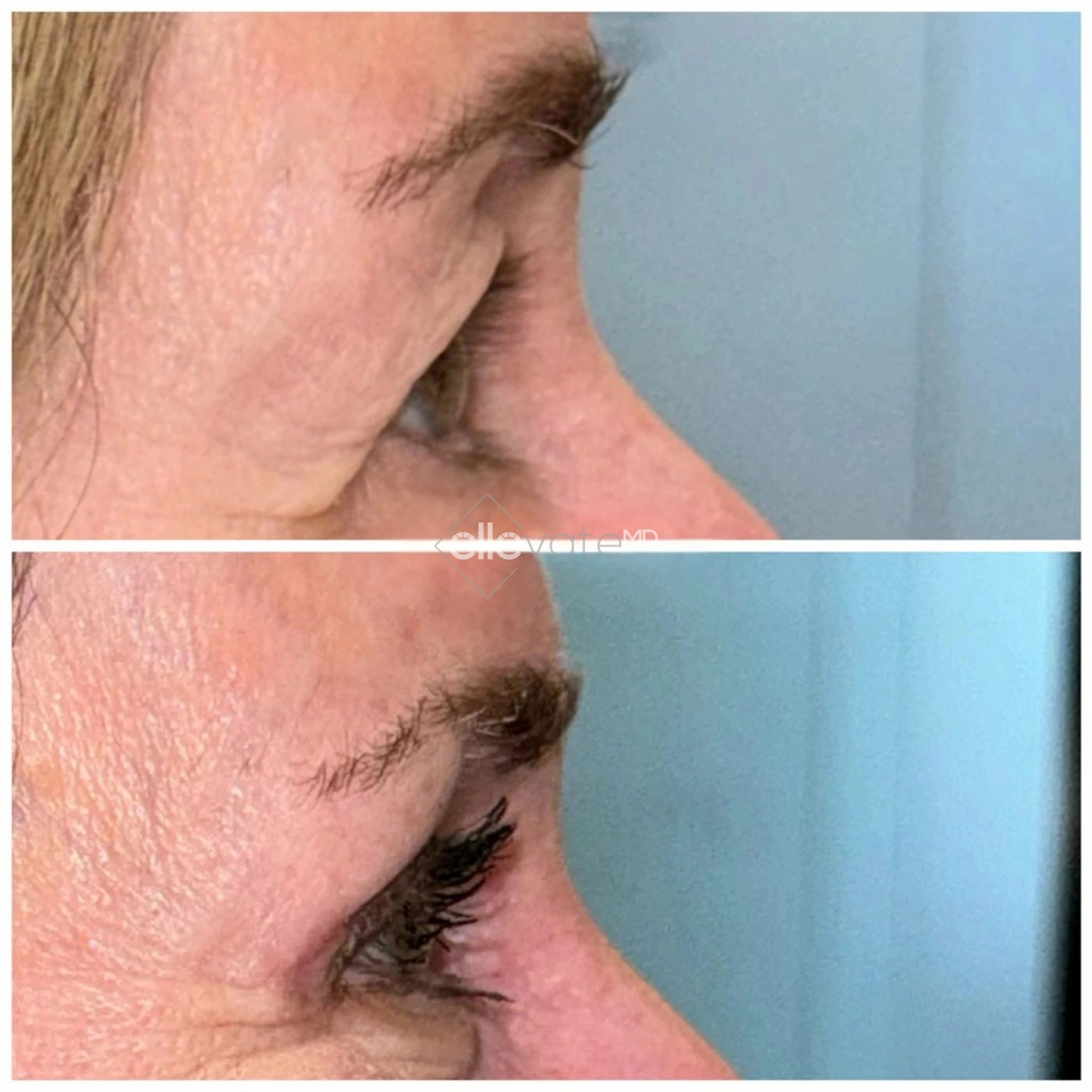 ellevate - 2025-03-23T124028.323