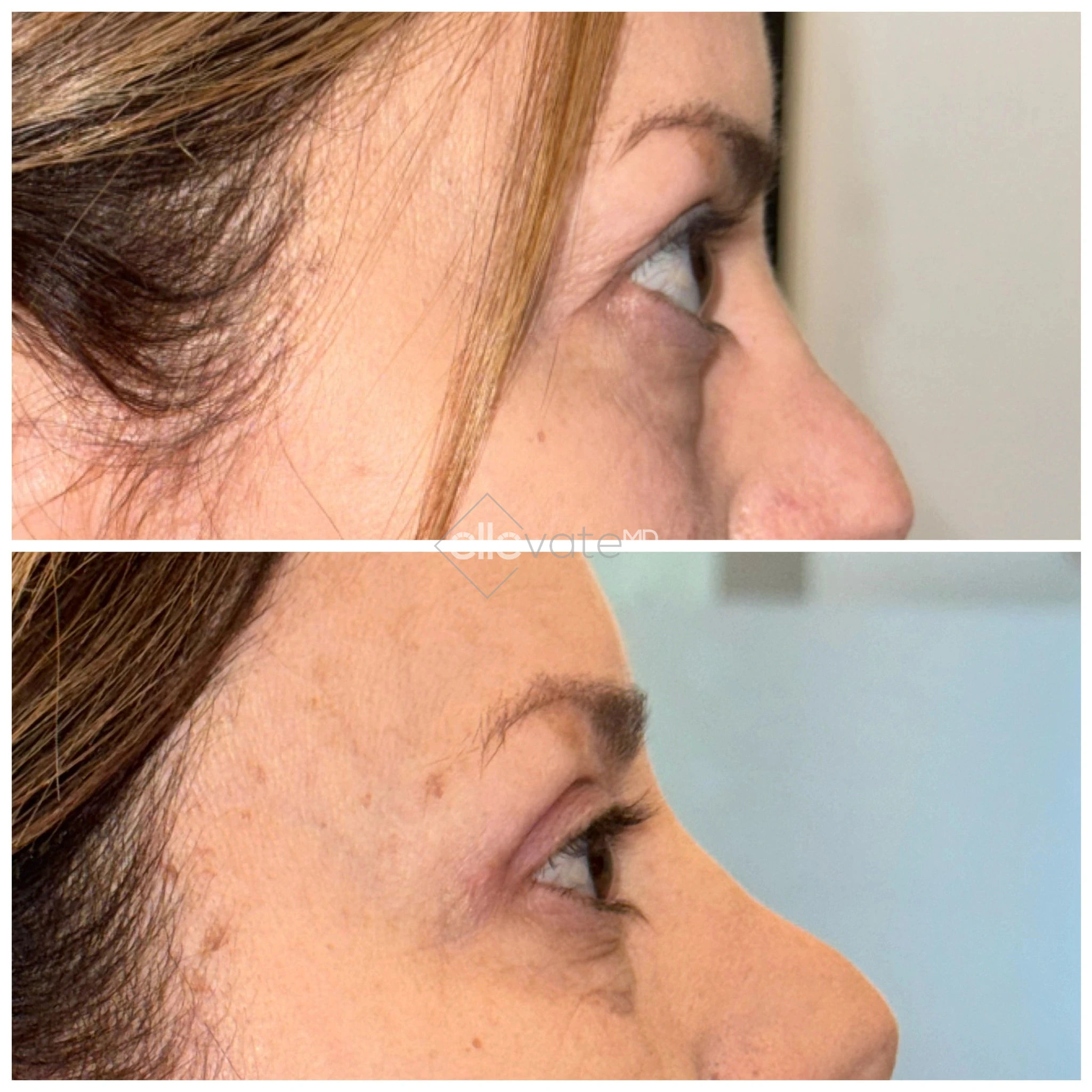 ellevate - 2025-03-23T124348.286