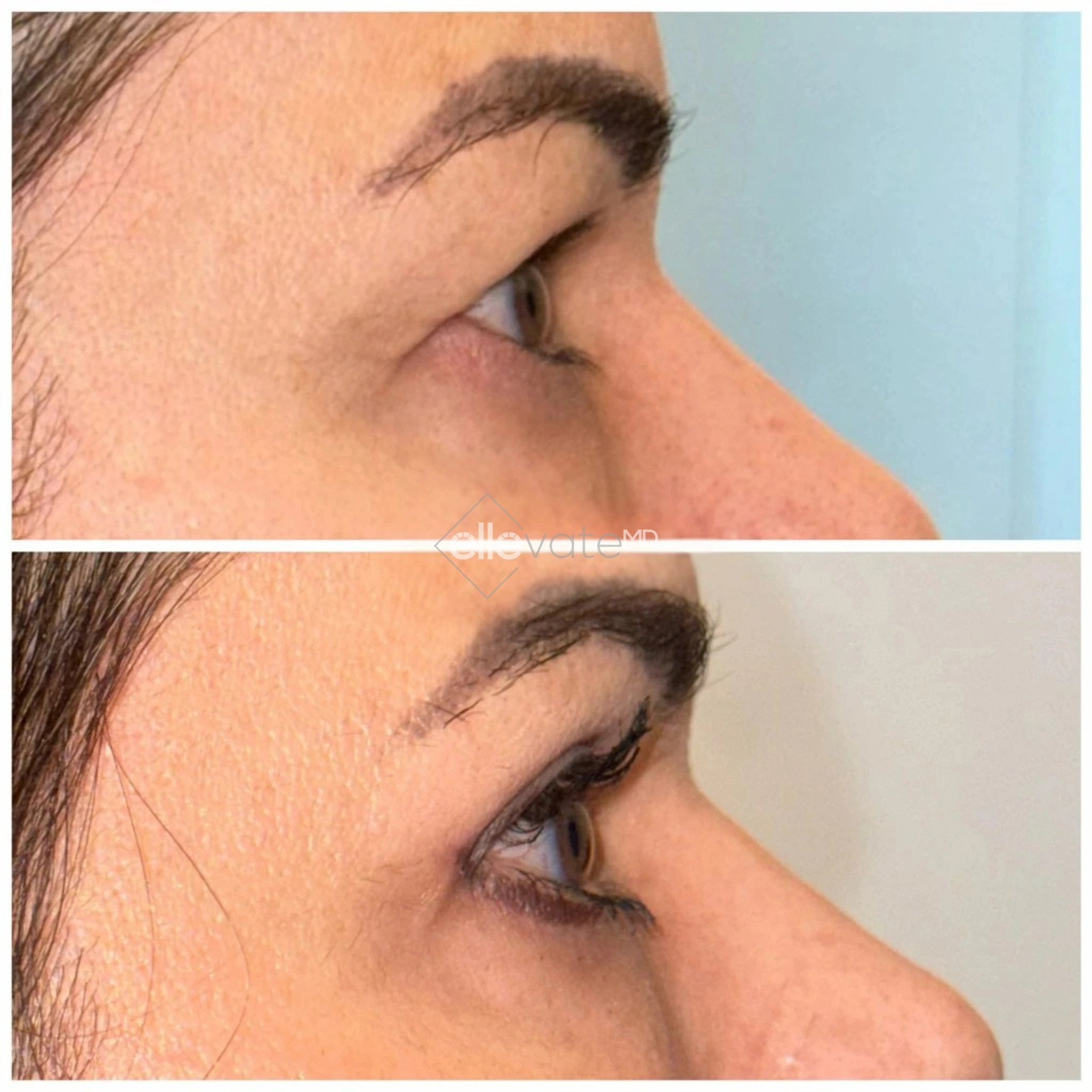 ellevate - 2025-03-23T124514.157