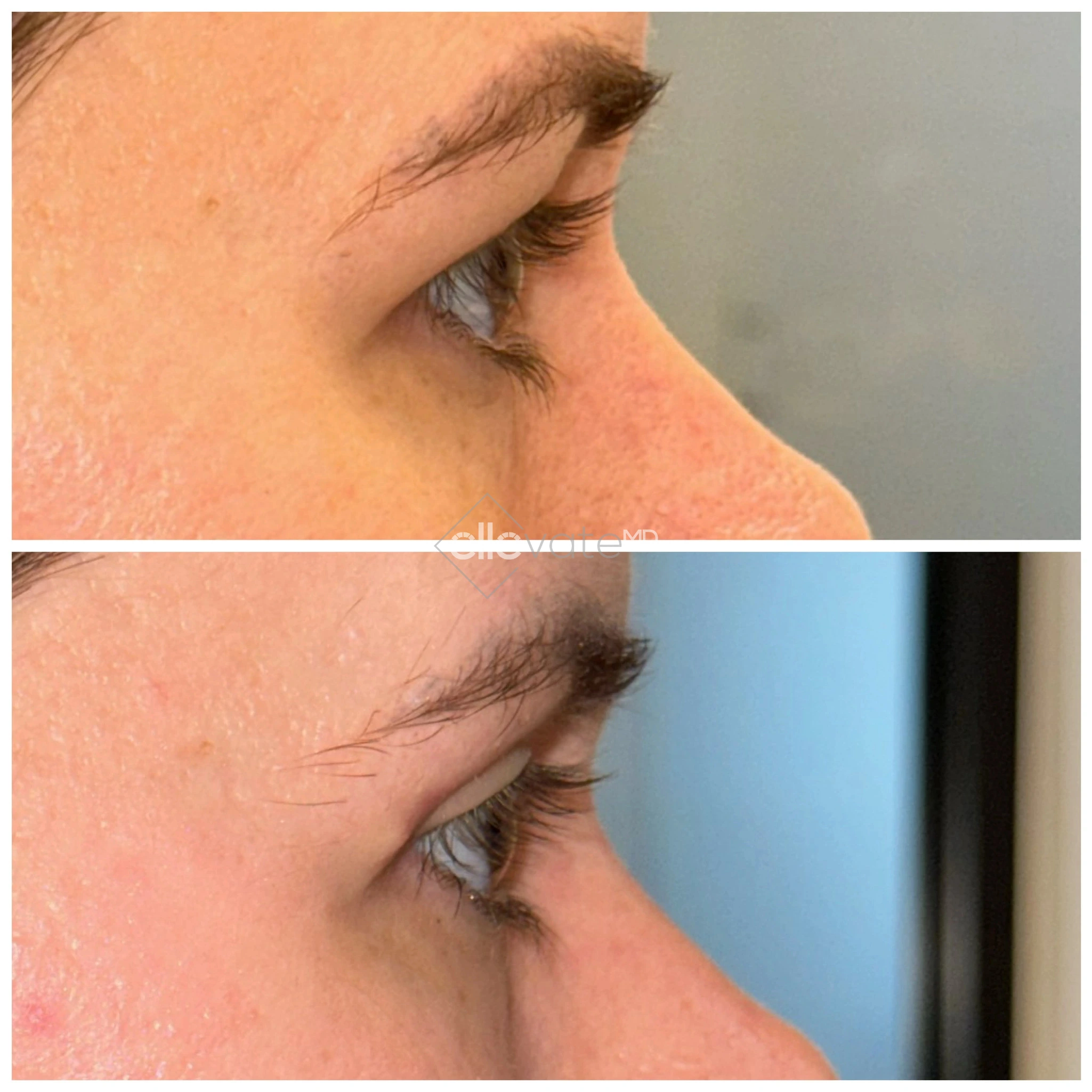 ellevate - 2025-03-23T124709.484