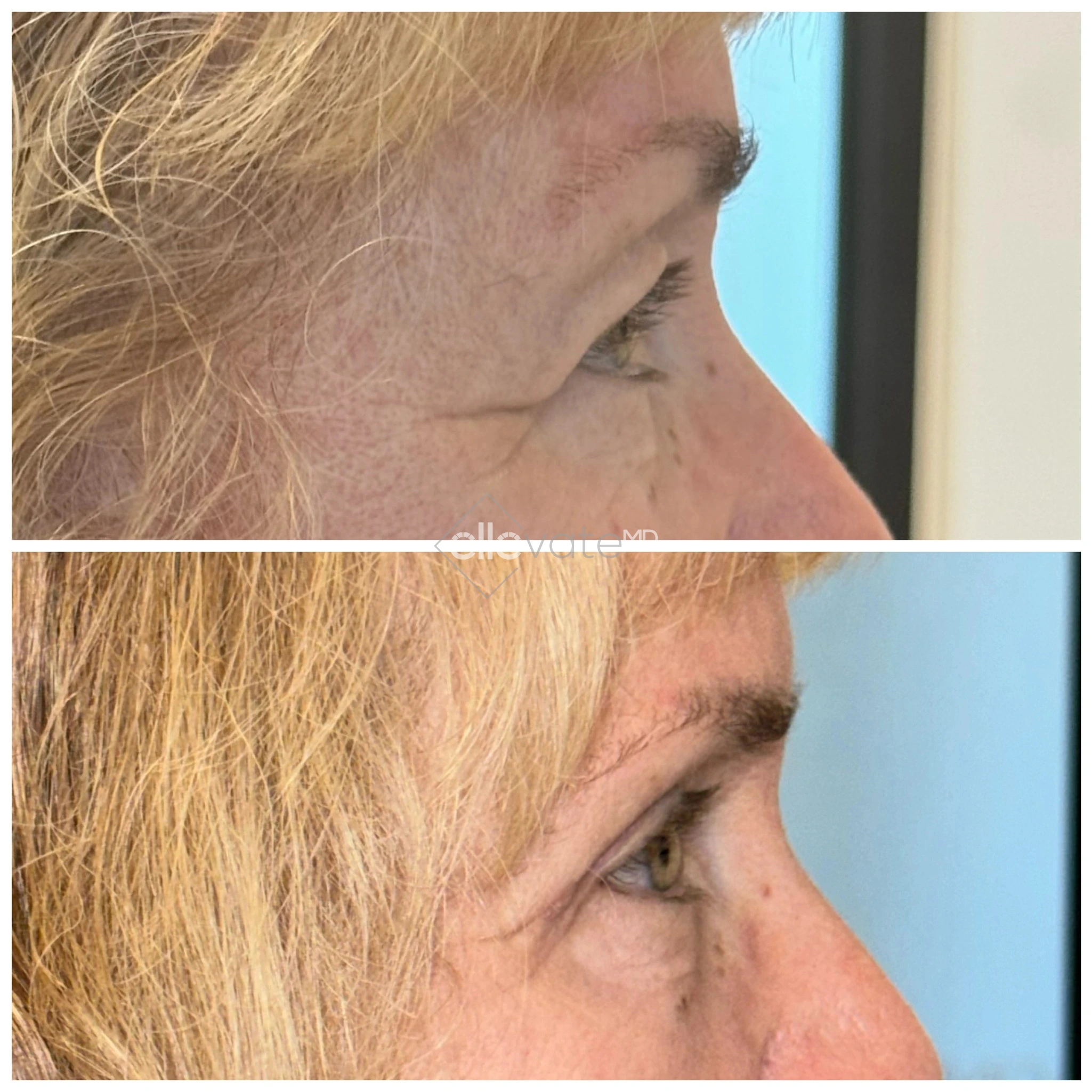 ellevate - 2025-03-23T124952.285