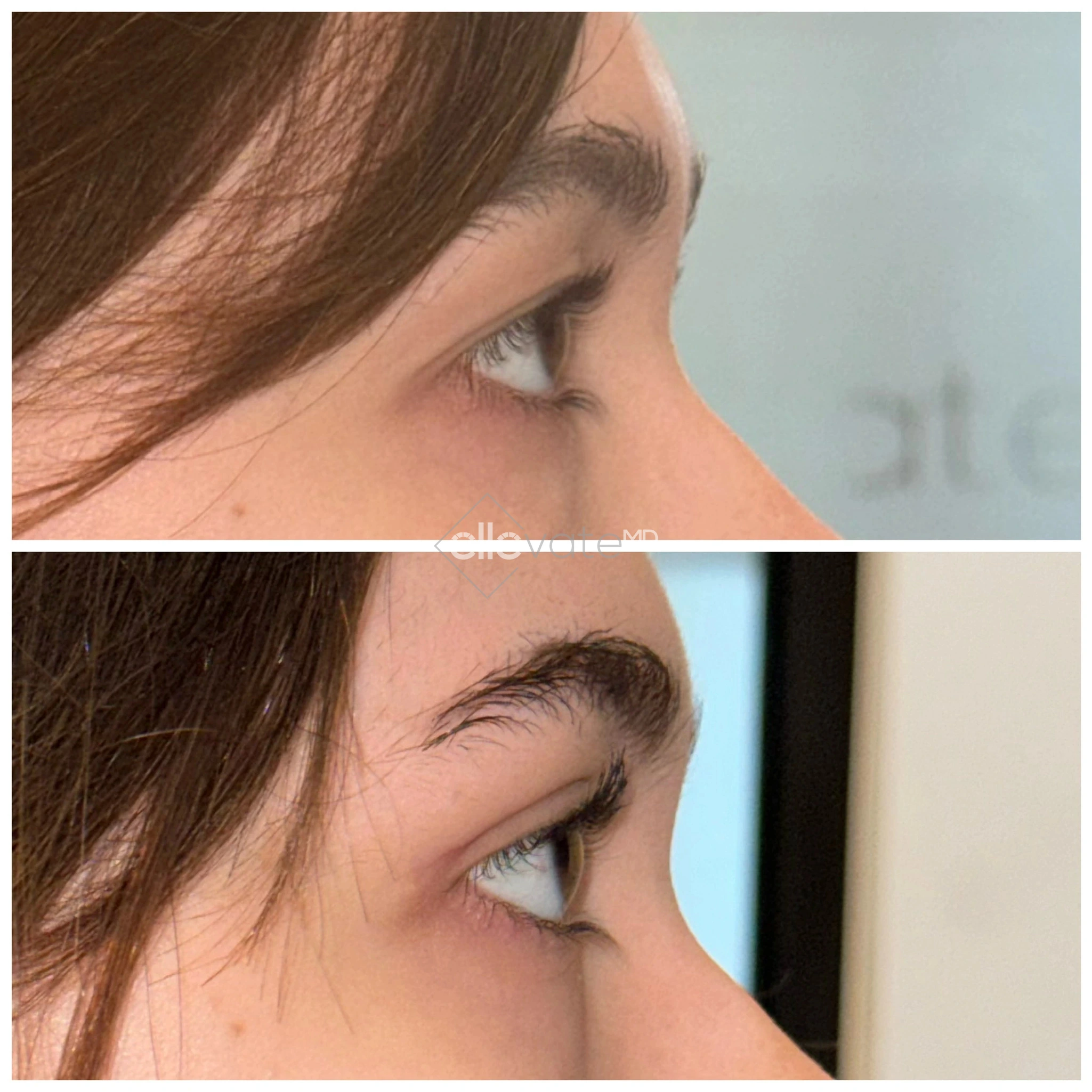 ellevate - 2025-03-23T125132.384