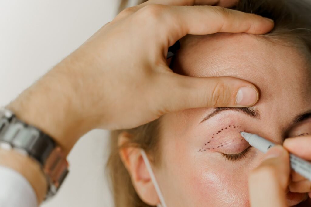 How Painful Is Blepharoplasty? Banner