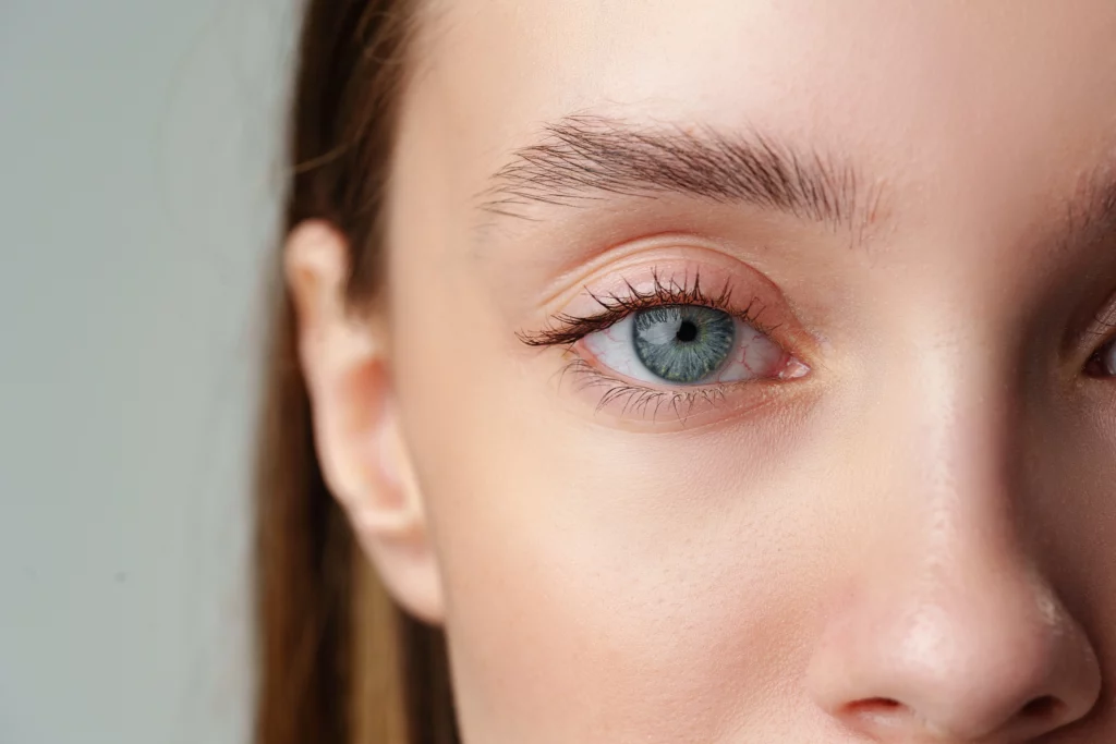 What Is the Difference Between Blepharoplasty and Ptosis Repair? Banner