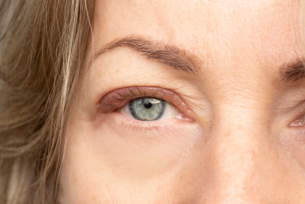 Blepharoplasty for Hooded Eyes: The Guide Banner