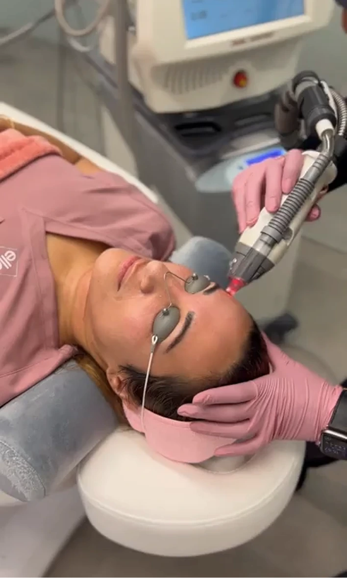 Practitioner holding Fraxel laser handpiece against patient's face during treatment session