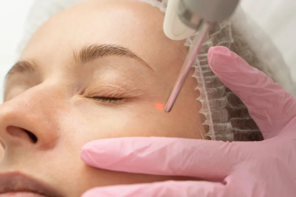 Is Fraxel Laser a Good Alternative to Eyelid Surgery? Banner