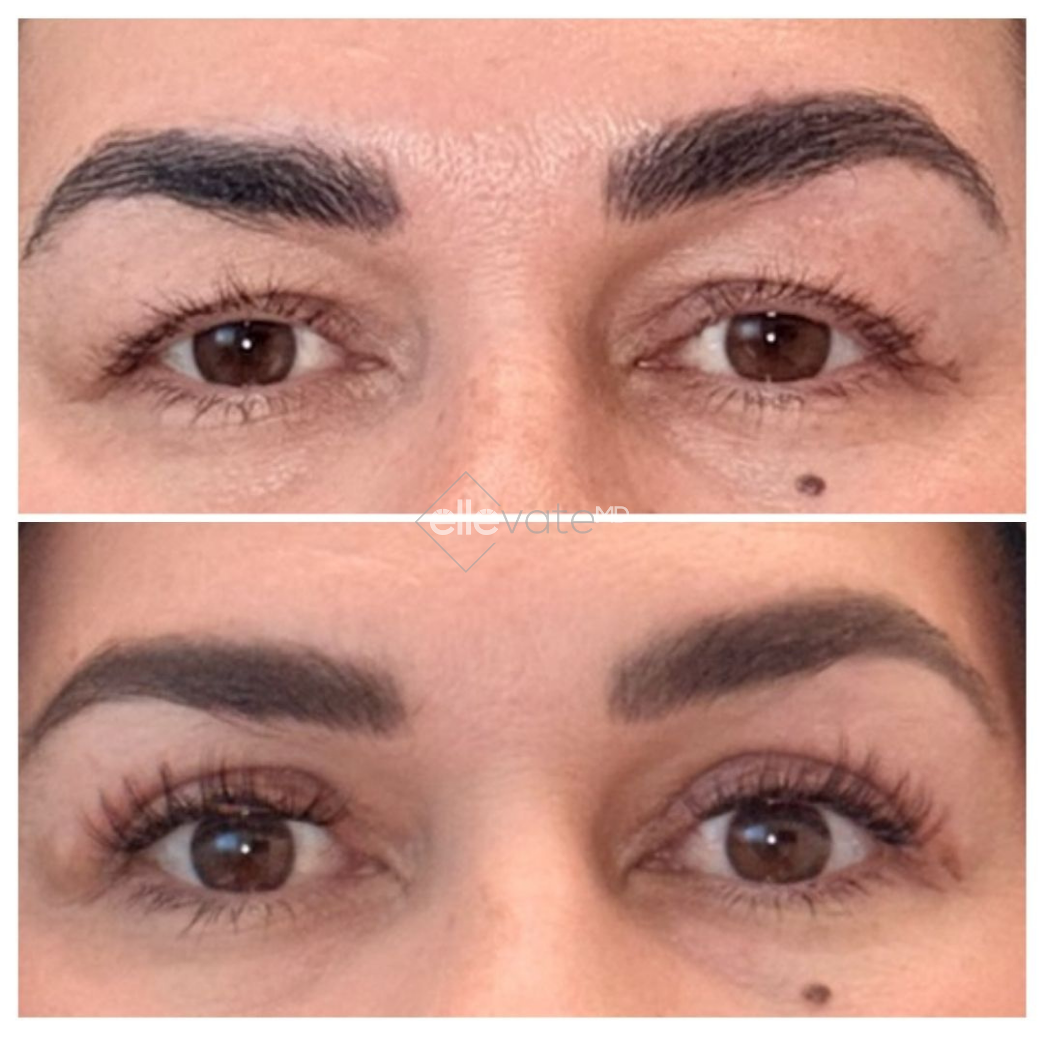 Before and after Signature Lift treatment showing lifted eyelids and enhanced lash definition