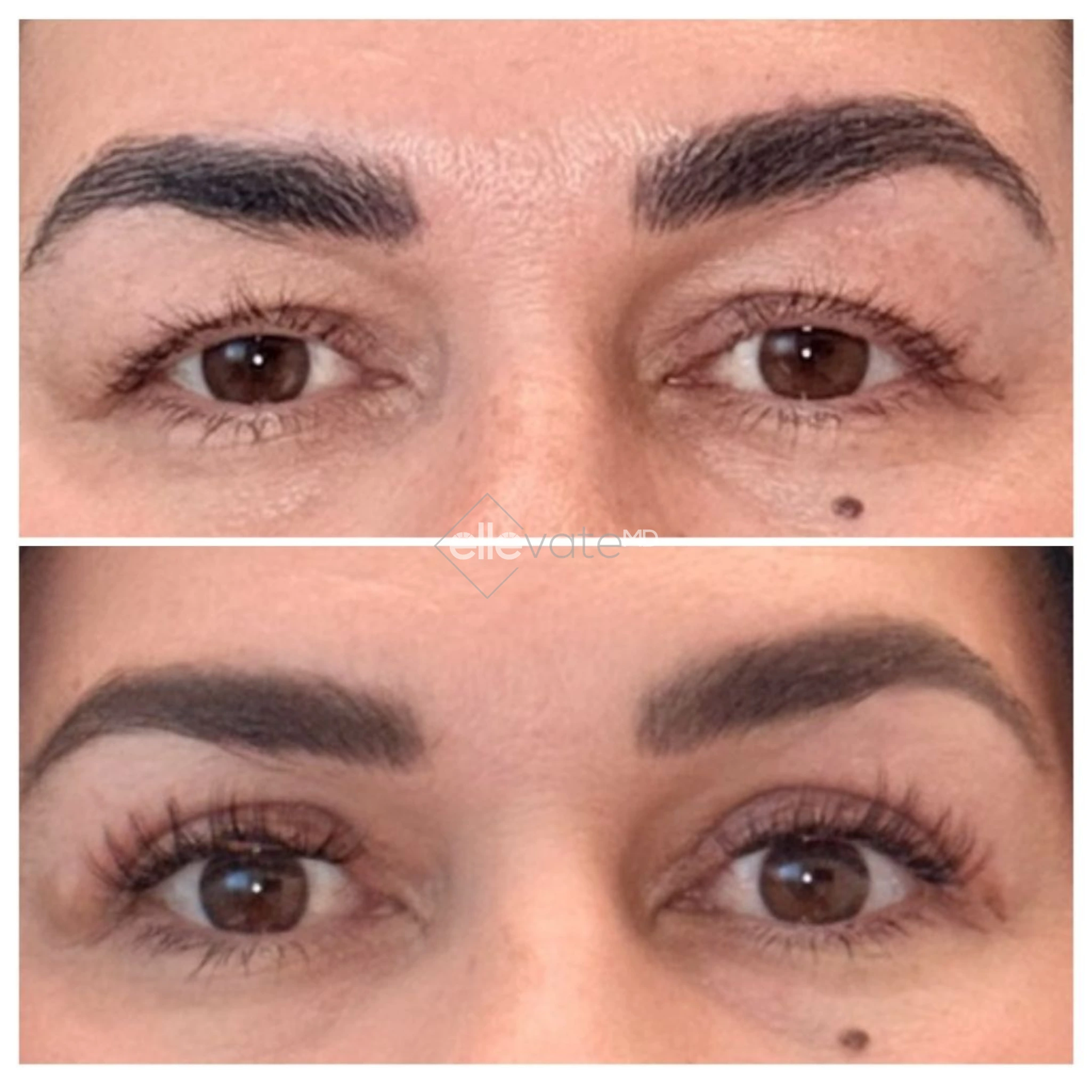 Before and after Signature Lift treatment showing lifted eyelids and enhanced lash definition
