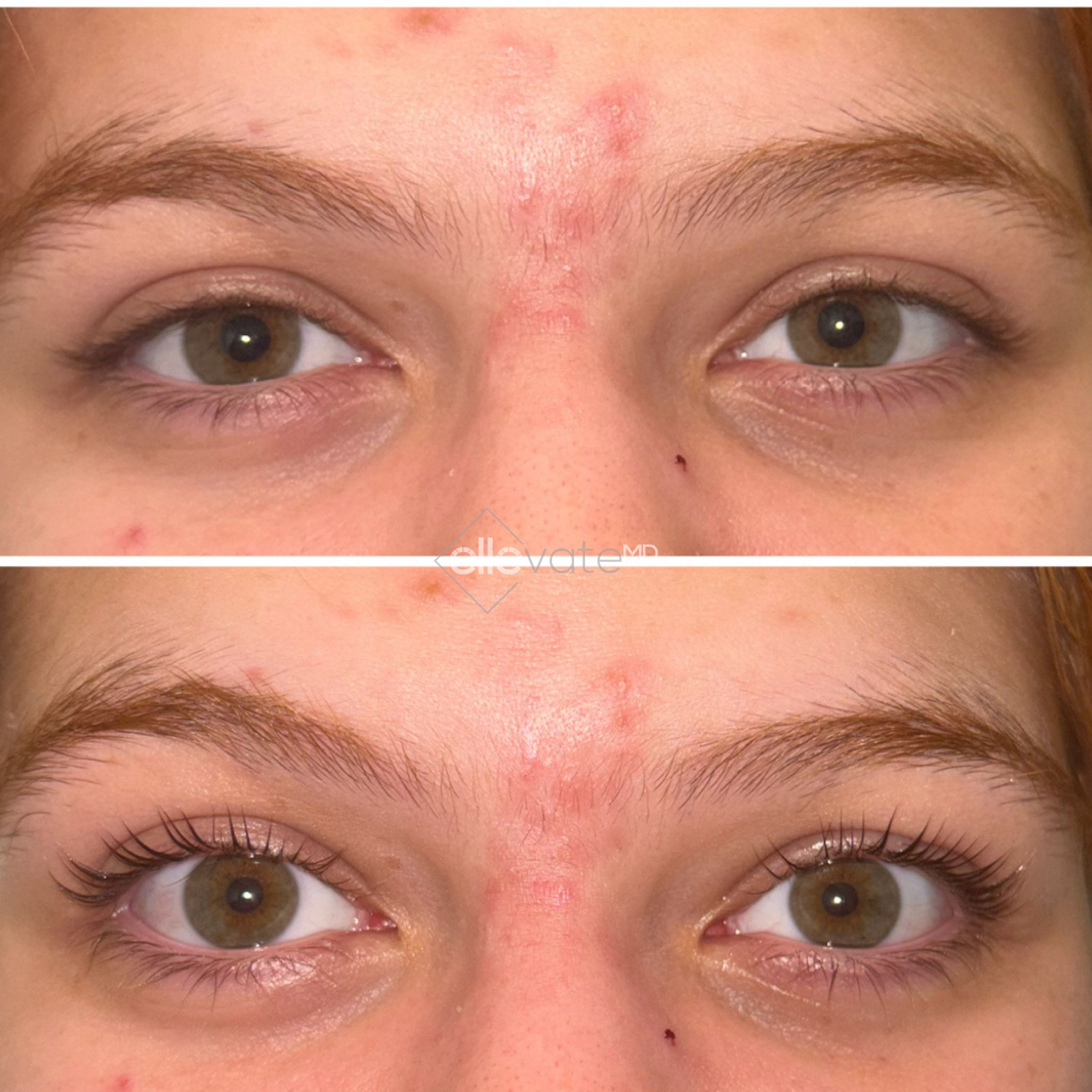 Before and after lash lift showing lifted and curled lashes in the after photo