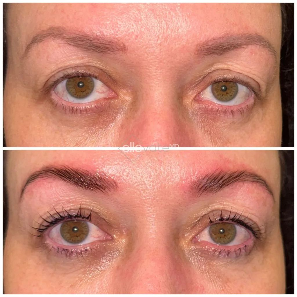 Before and after lash lift treatment showing enhanced lash curl and definition